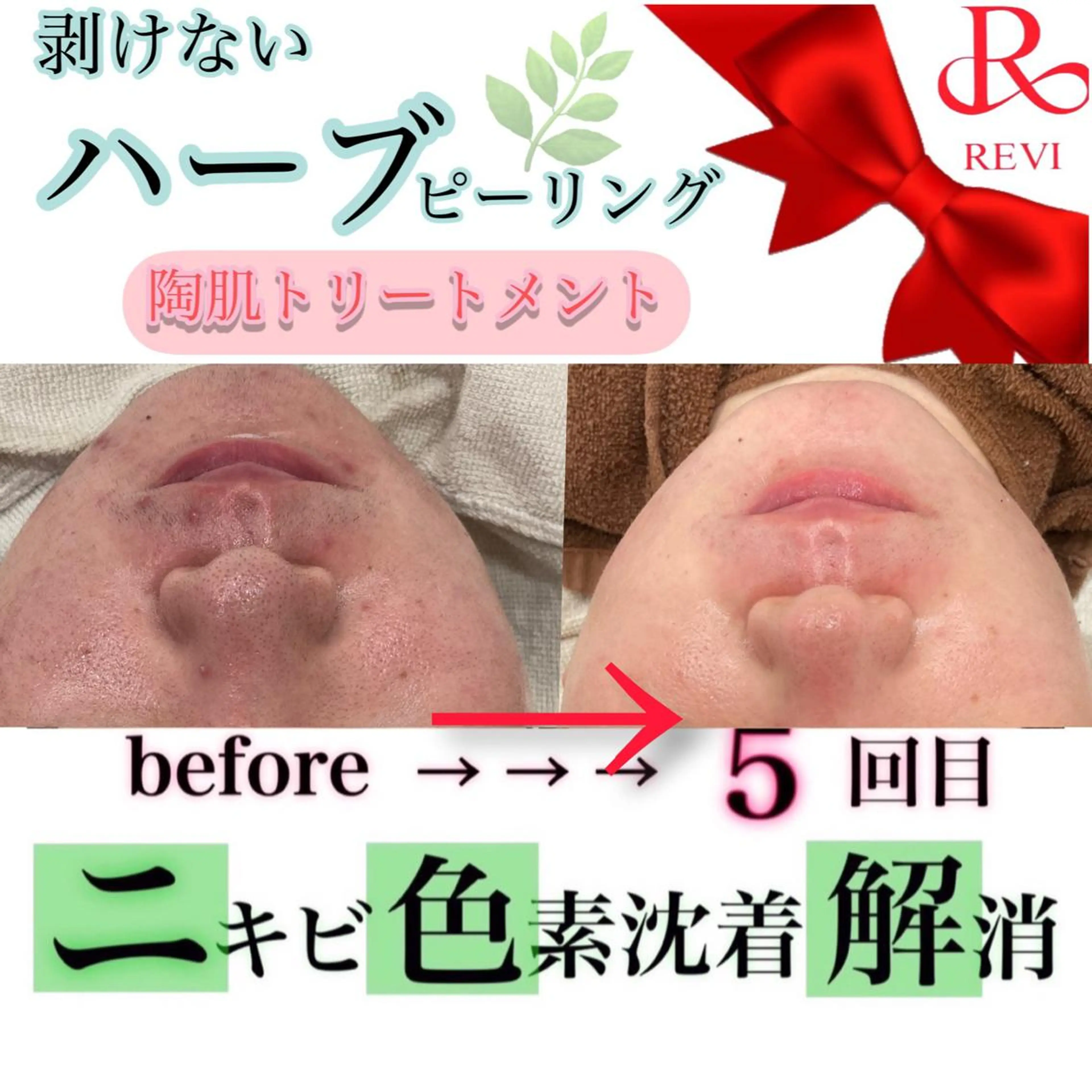 laluna saki...のその他イメージ