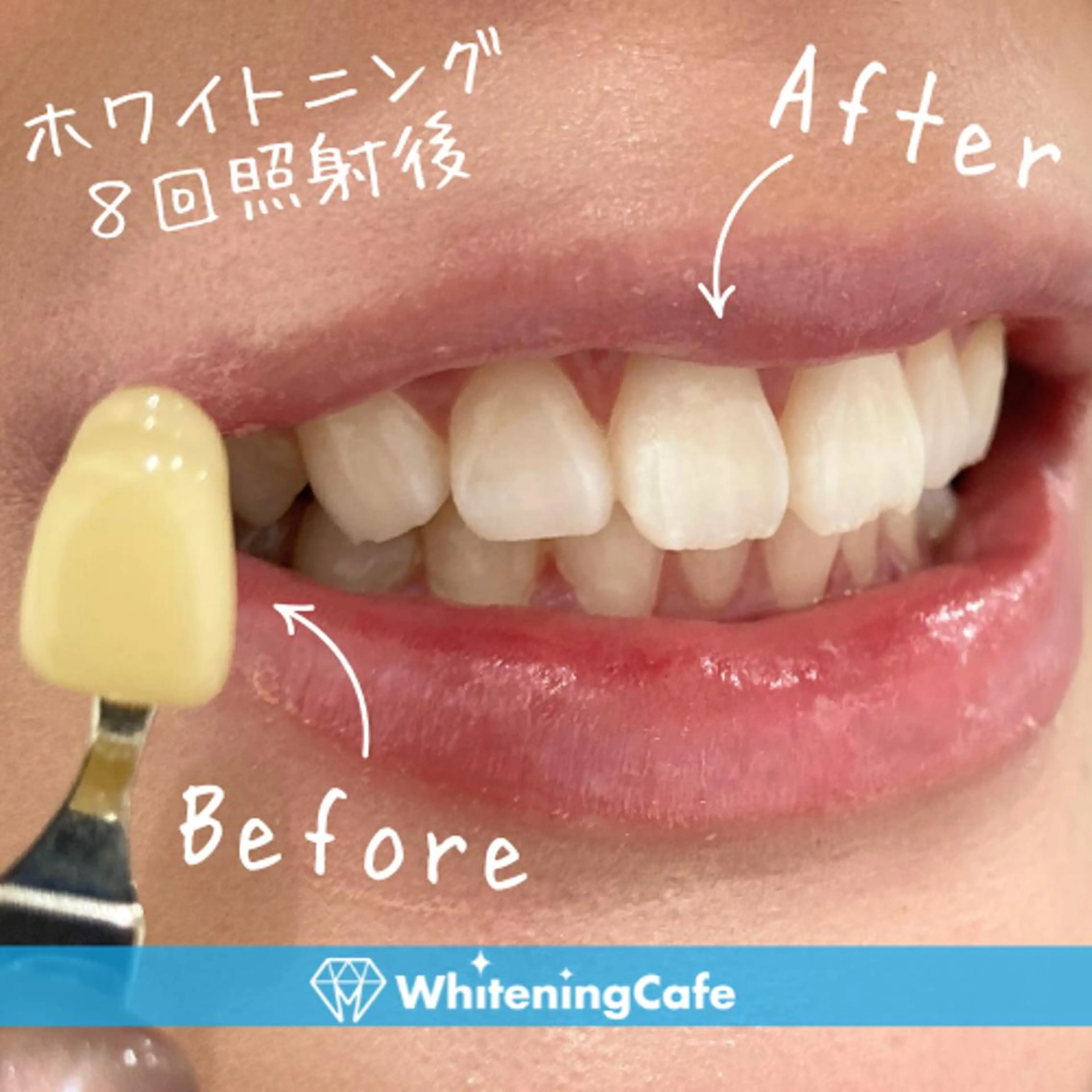 エステ リラク ホワイトニング カフェ志木店のエステ・リラクイメージ