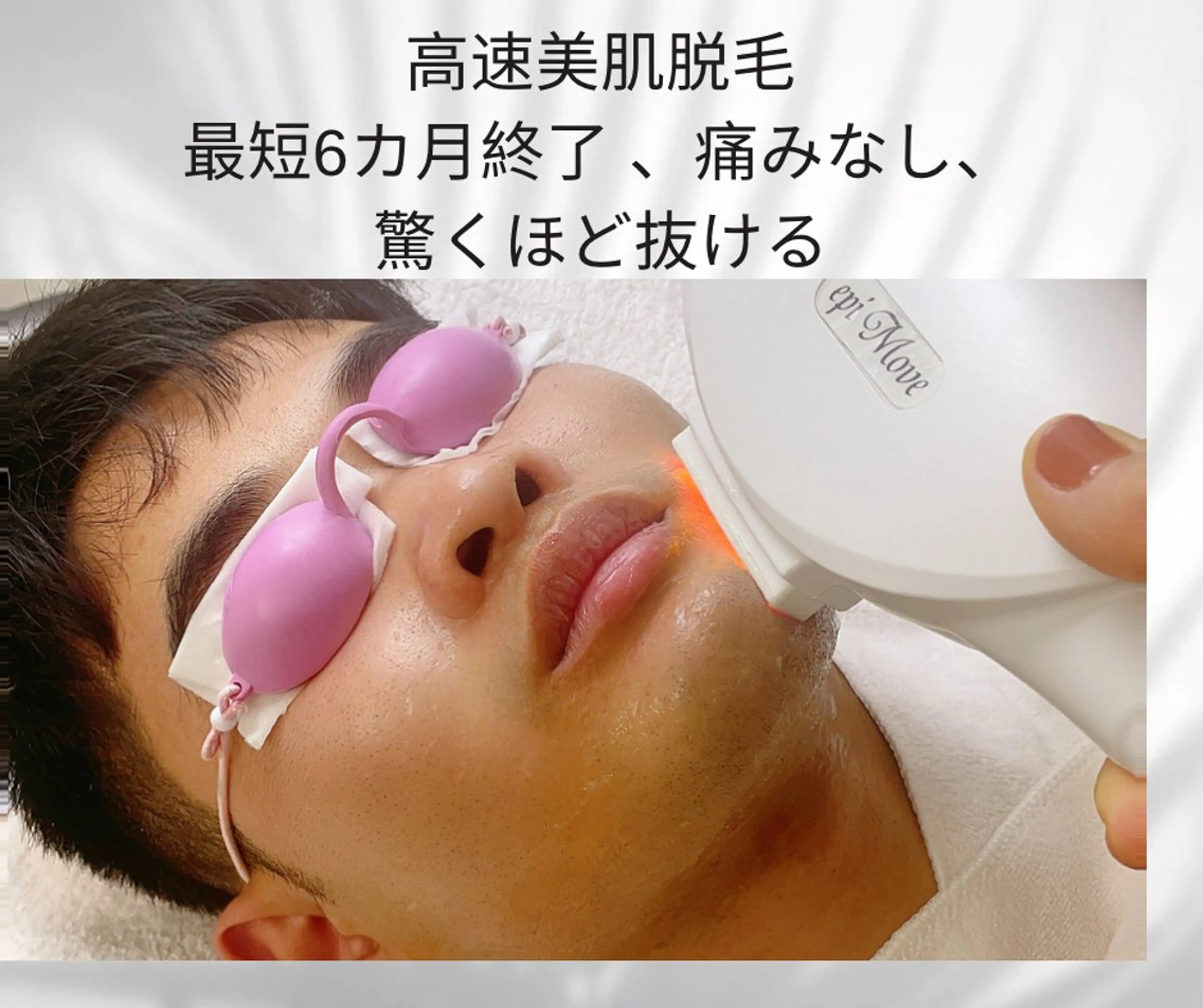 鼻下，口下，顎下高速美肌脱毛，痛みが少ないの写真