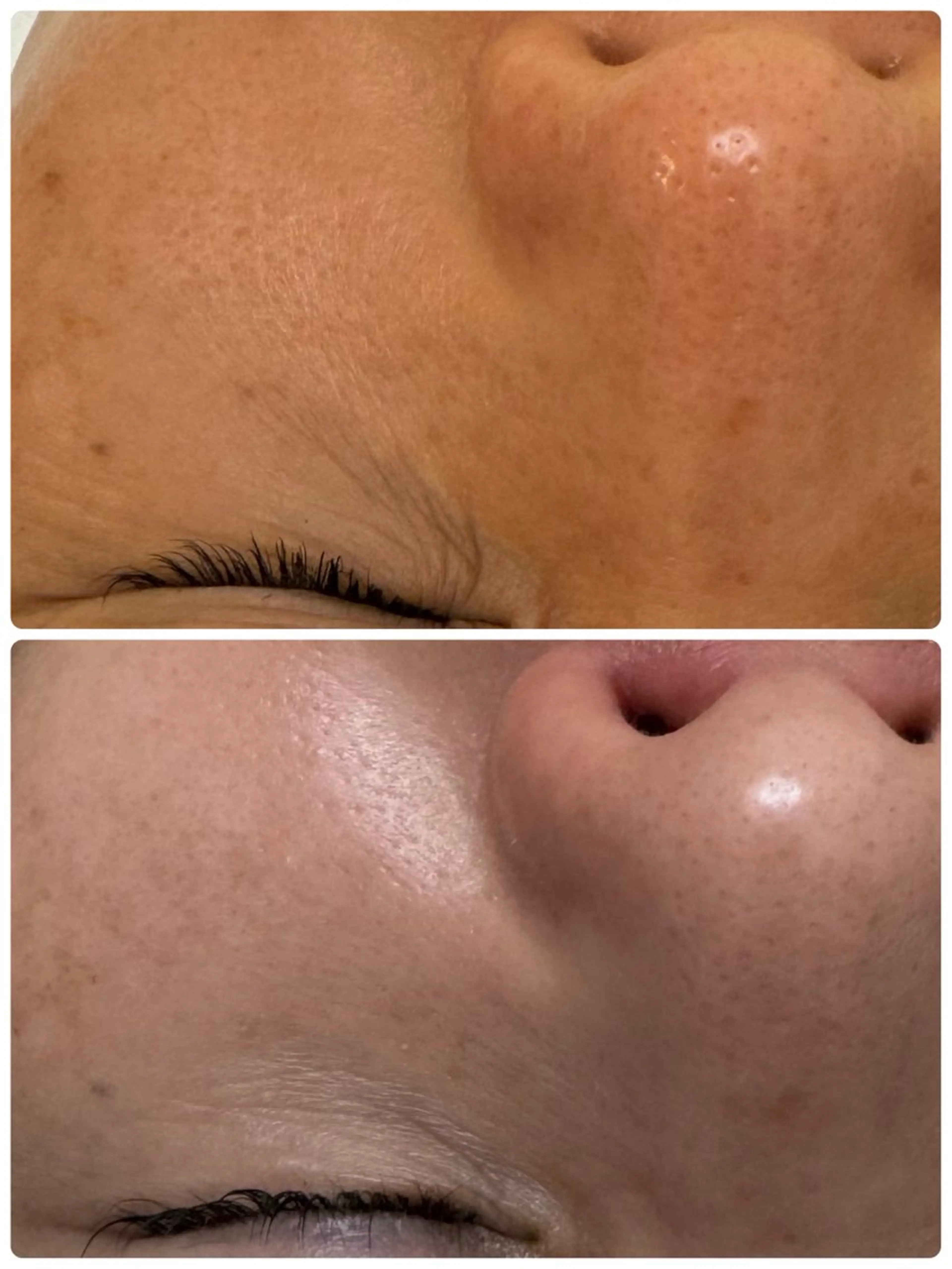 シミ毛穴専門店 yucca(ユッカ)のエステ・リラクイメージ