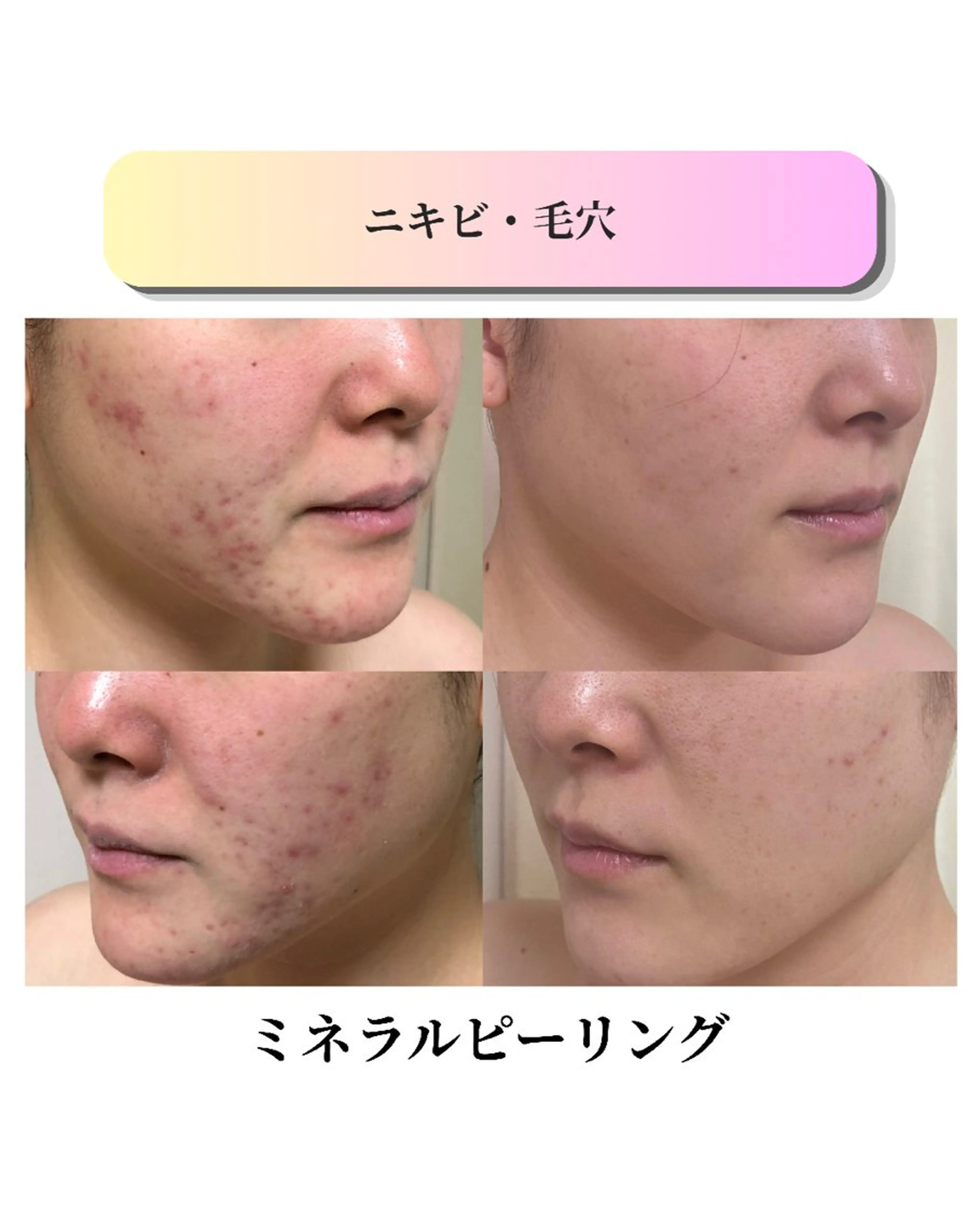 エステ ローズフィールド 森岡朋美のエステ・リラクイメージ