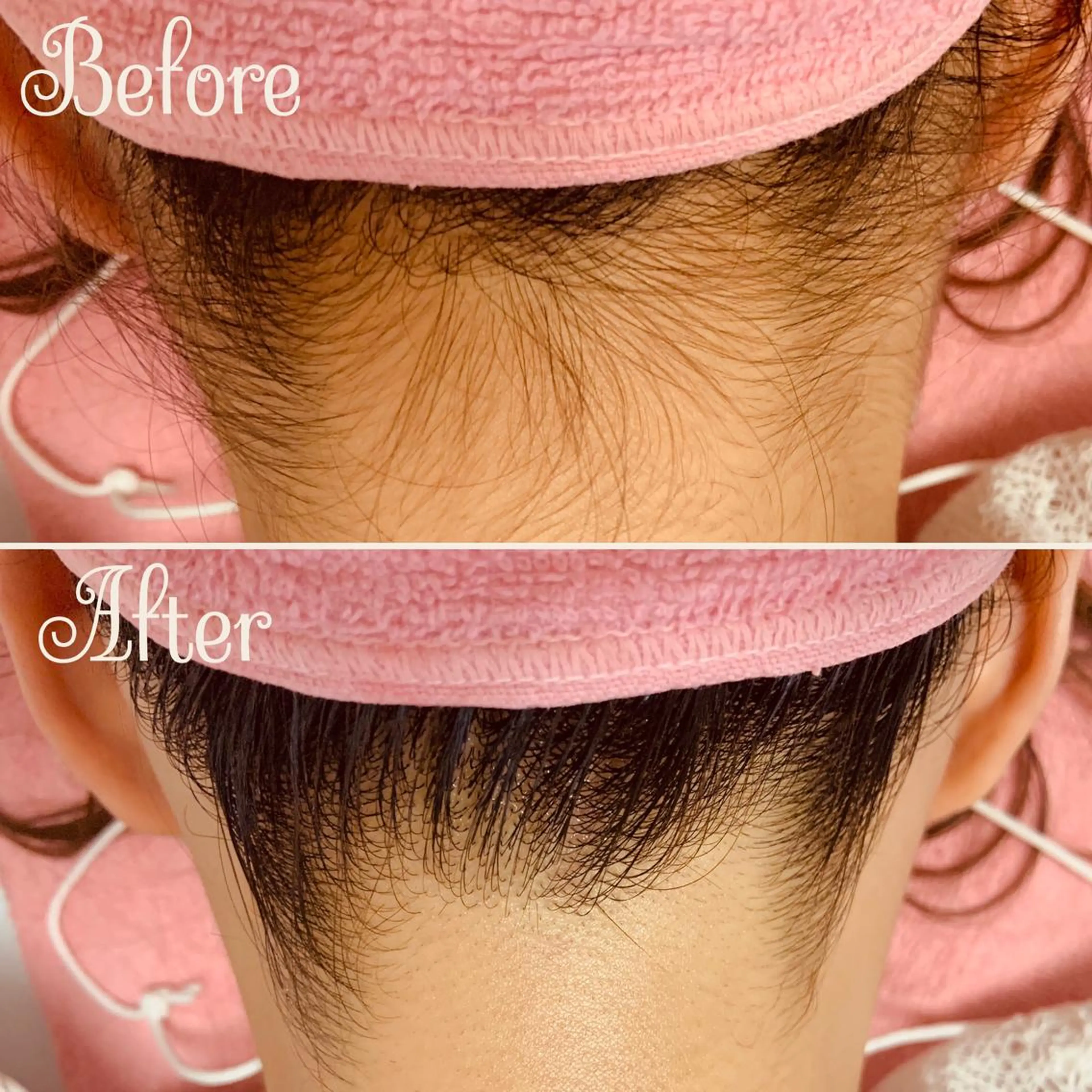 Linomalie エステ/たるみ/脱毛のエステ・リラクイメージ