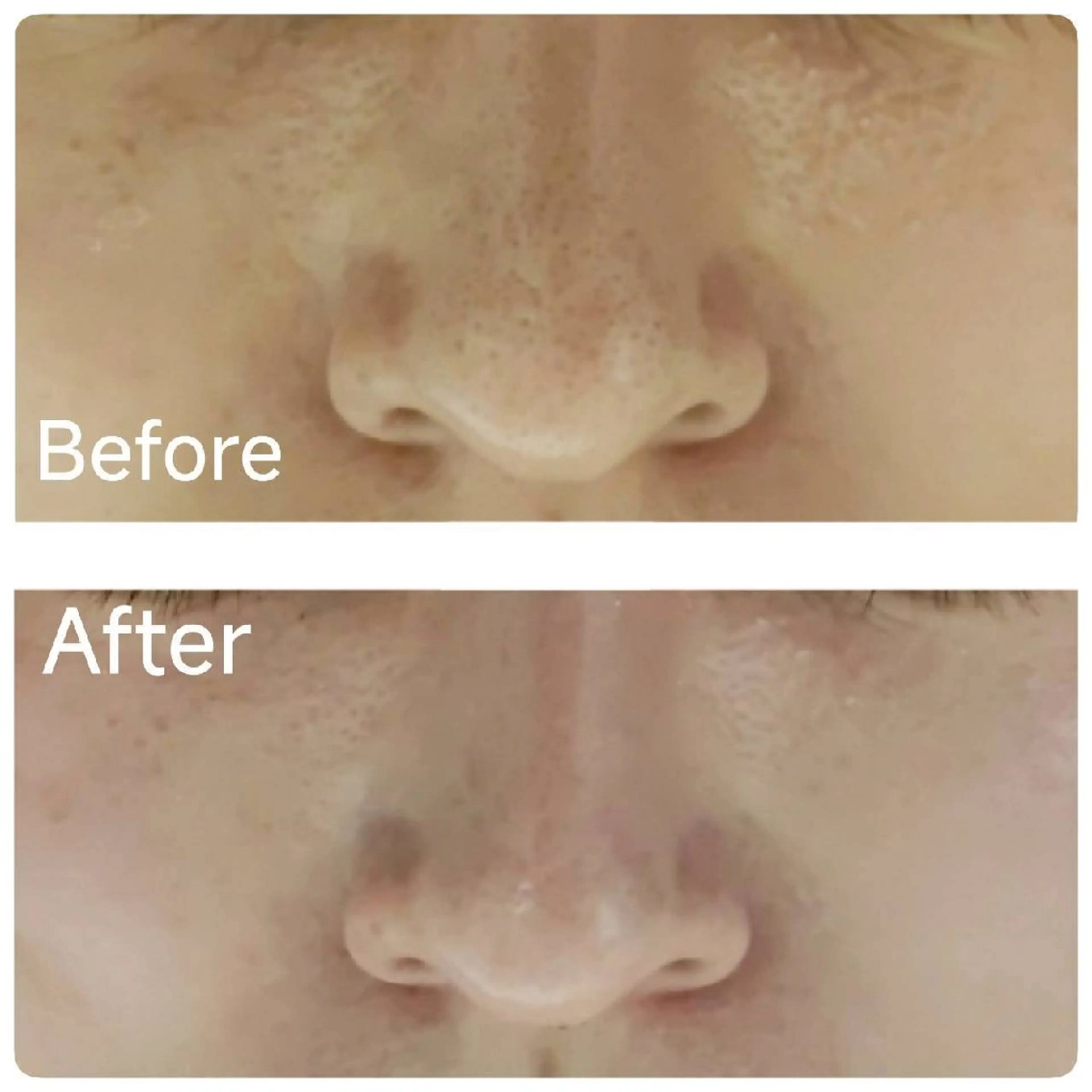 エステ リラク ICHOOSE/ 代々木上原のエステ・リラクイメージ