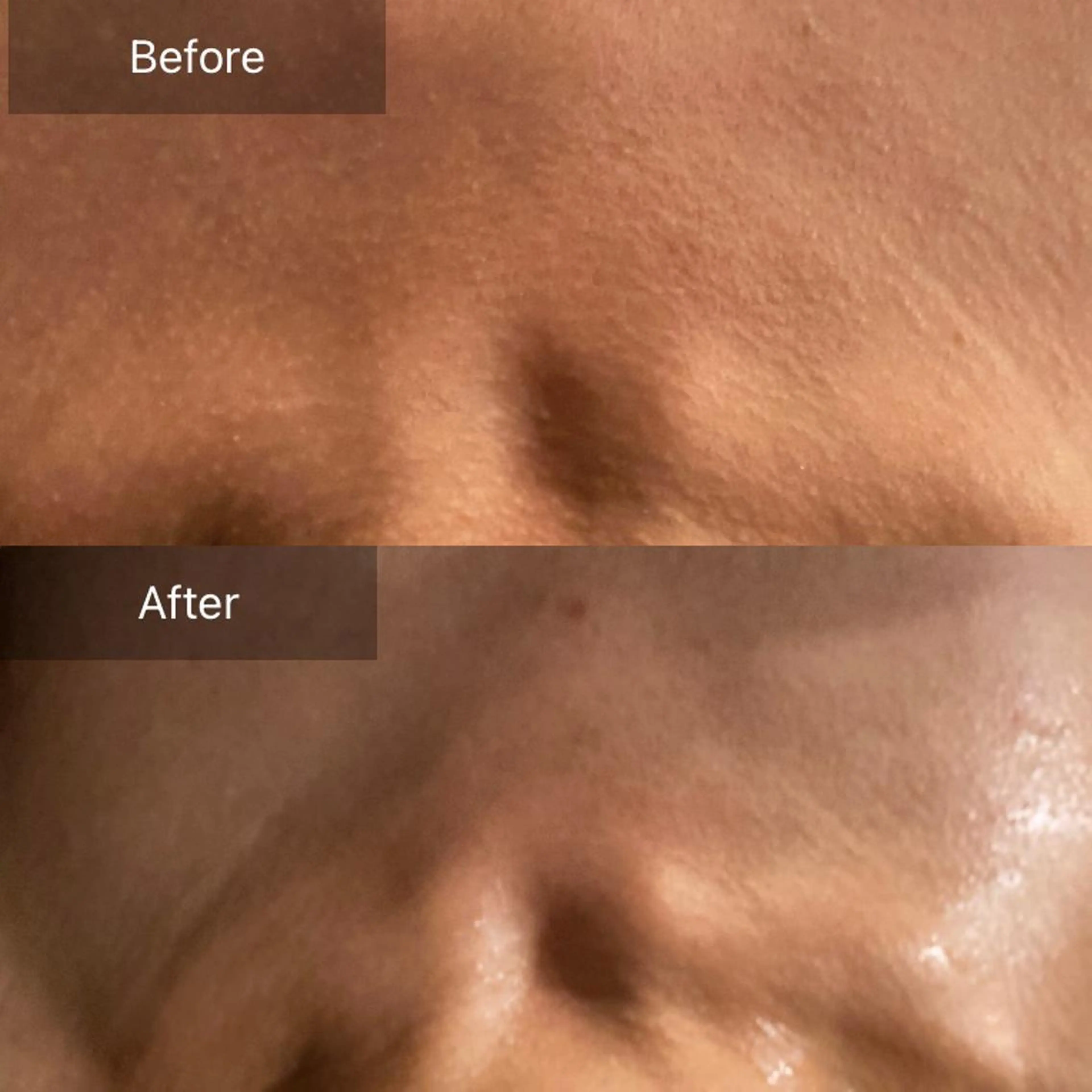 毛穴から始める肌メン テマンダリンオレンジのエステ・リラクイメージ