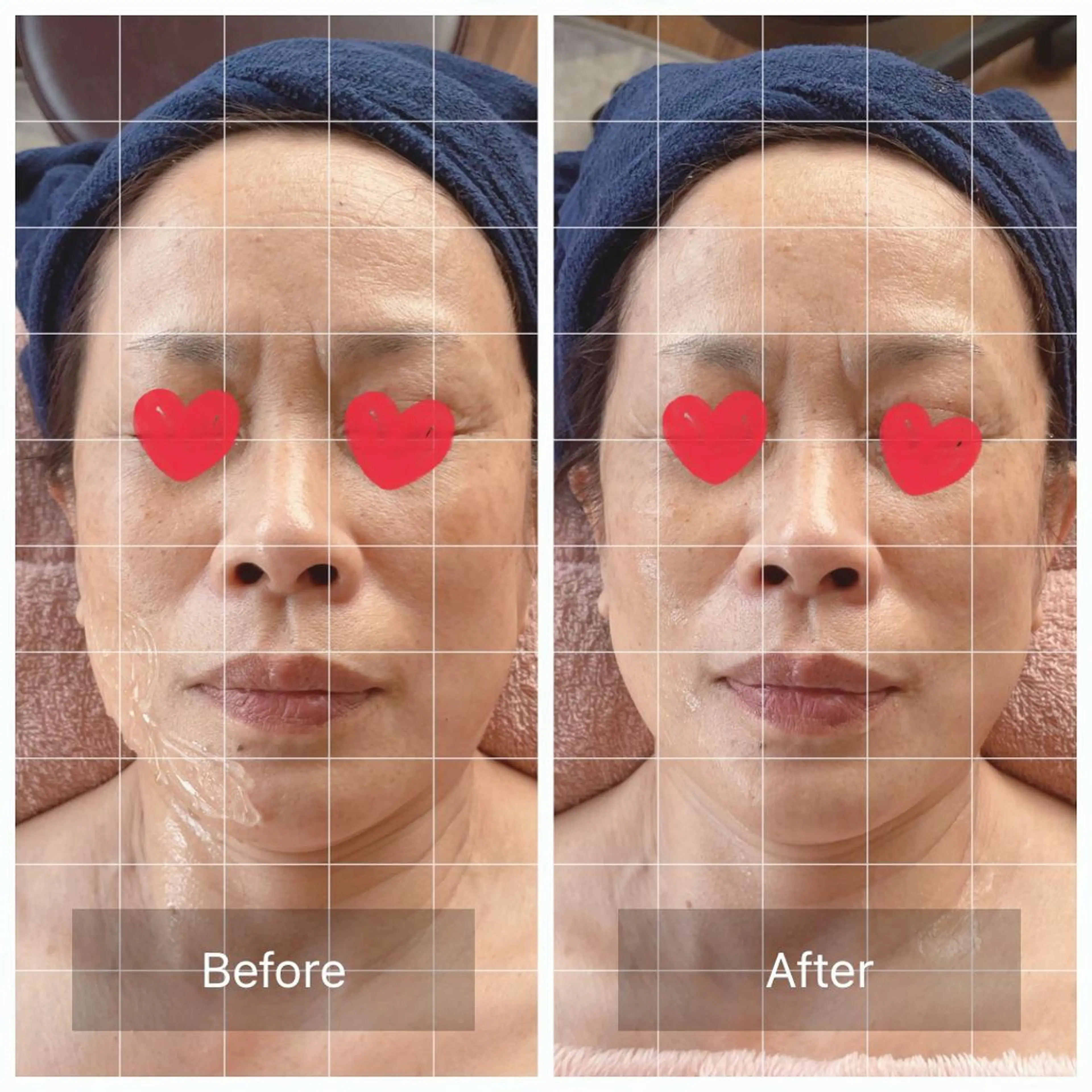 エステ en + エンプラスのその他イメージ