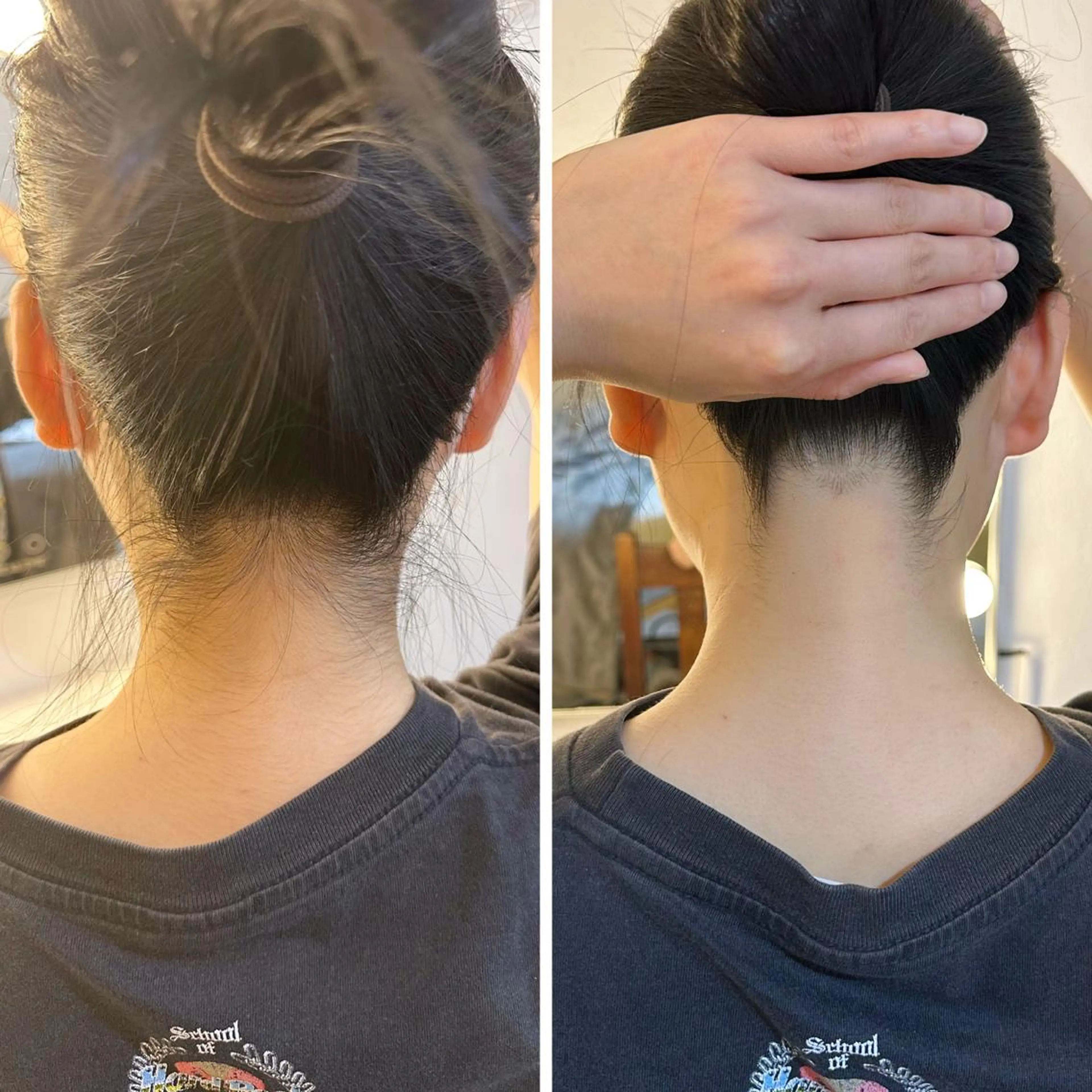 脱毛 うなじ脱毛/美肌脱毛 LABELのエステ・リラクイメージ