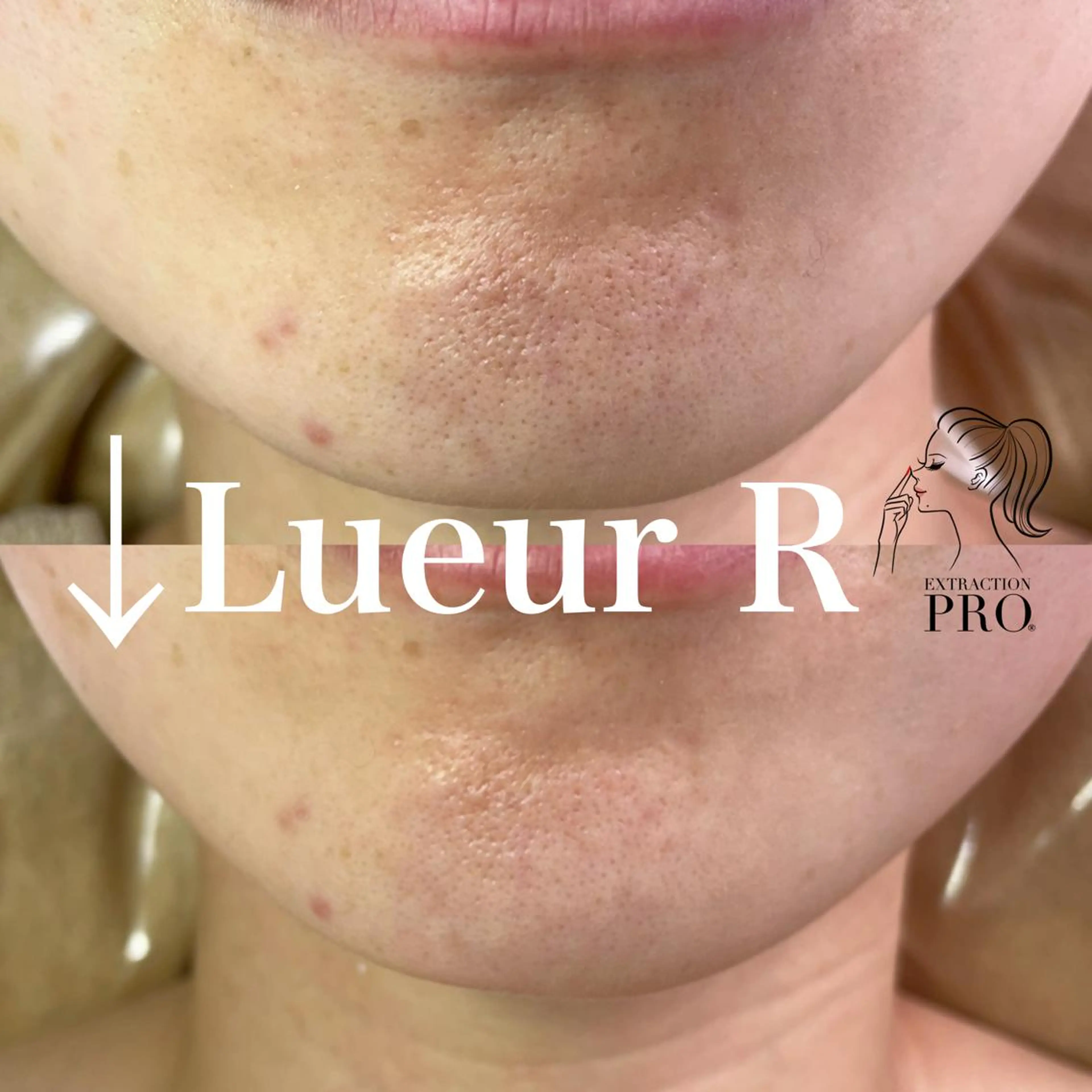 エステ 大久保 里奈のエステ・リラクイメージ