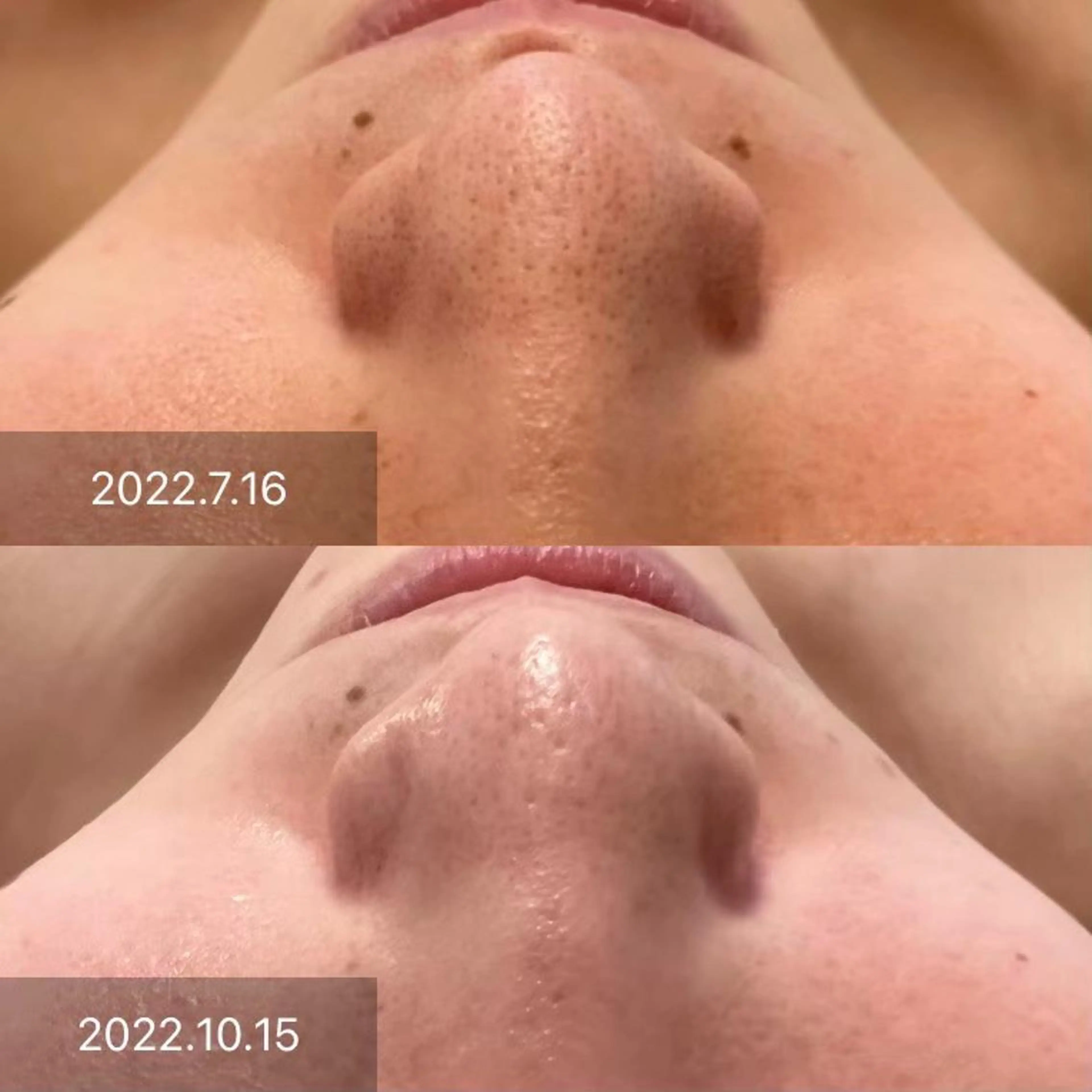 小尻・太もも痩せる パルタージュのエステ・リラクイメージ