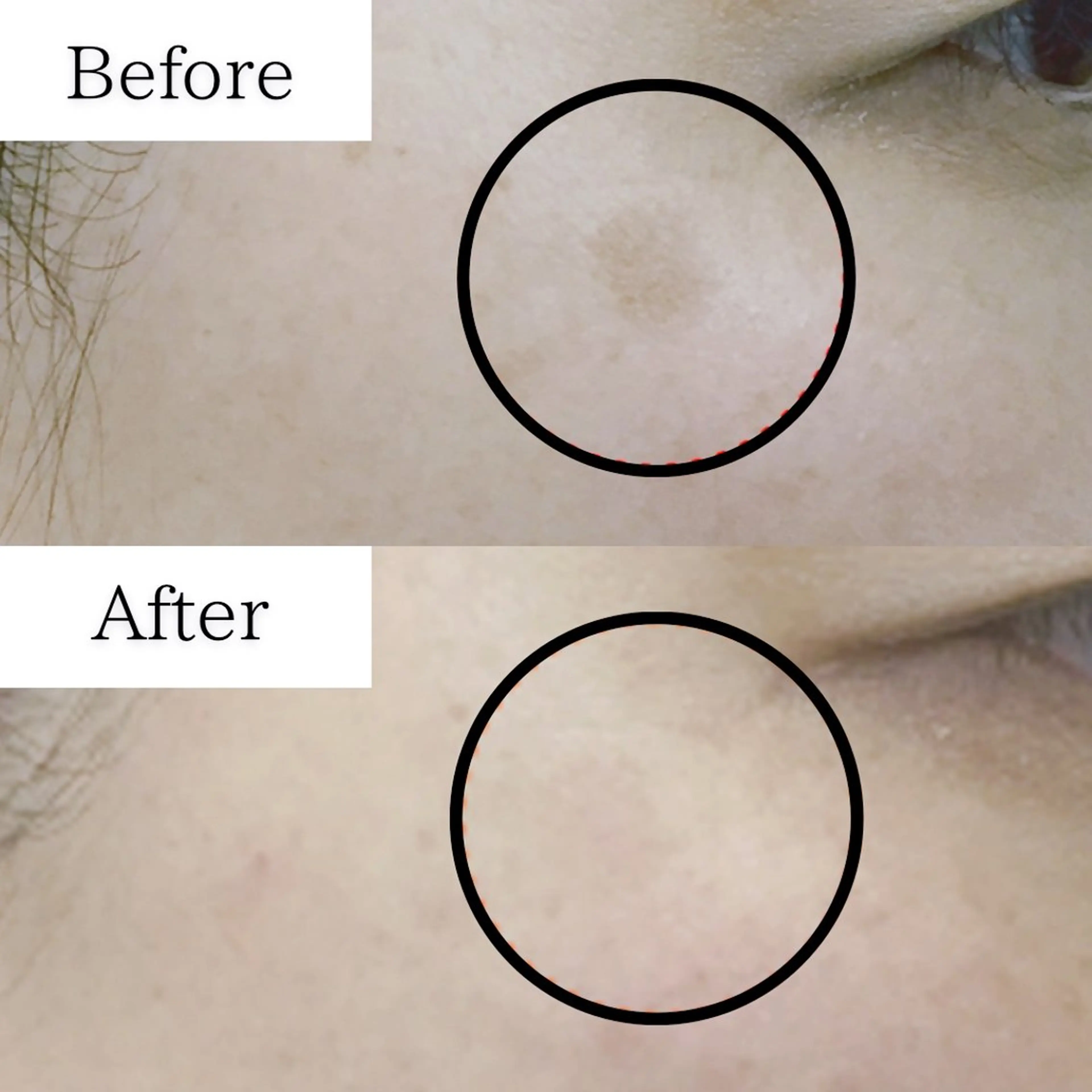 【シミしわ改善・予防ケア】お試し2回※男女OKの写真