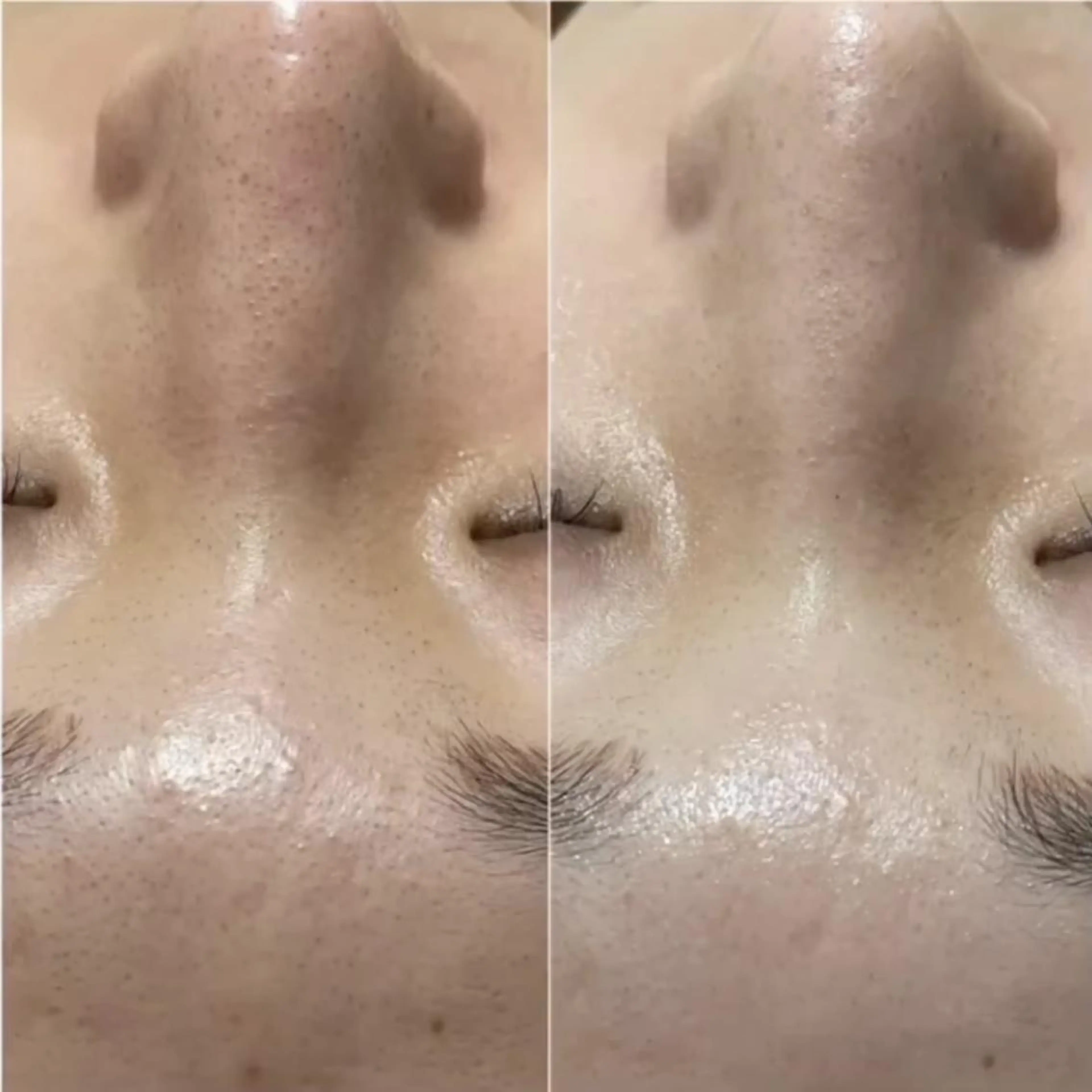 エステ ララ/ハーブ メゾンリュバンのエステ・リラクイメージ