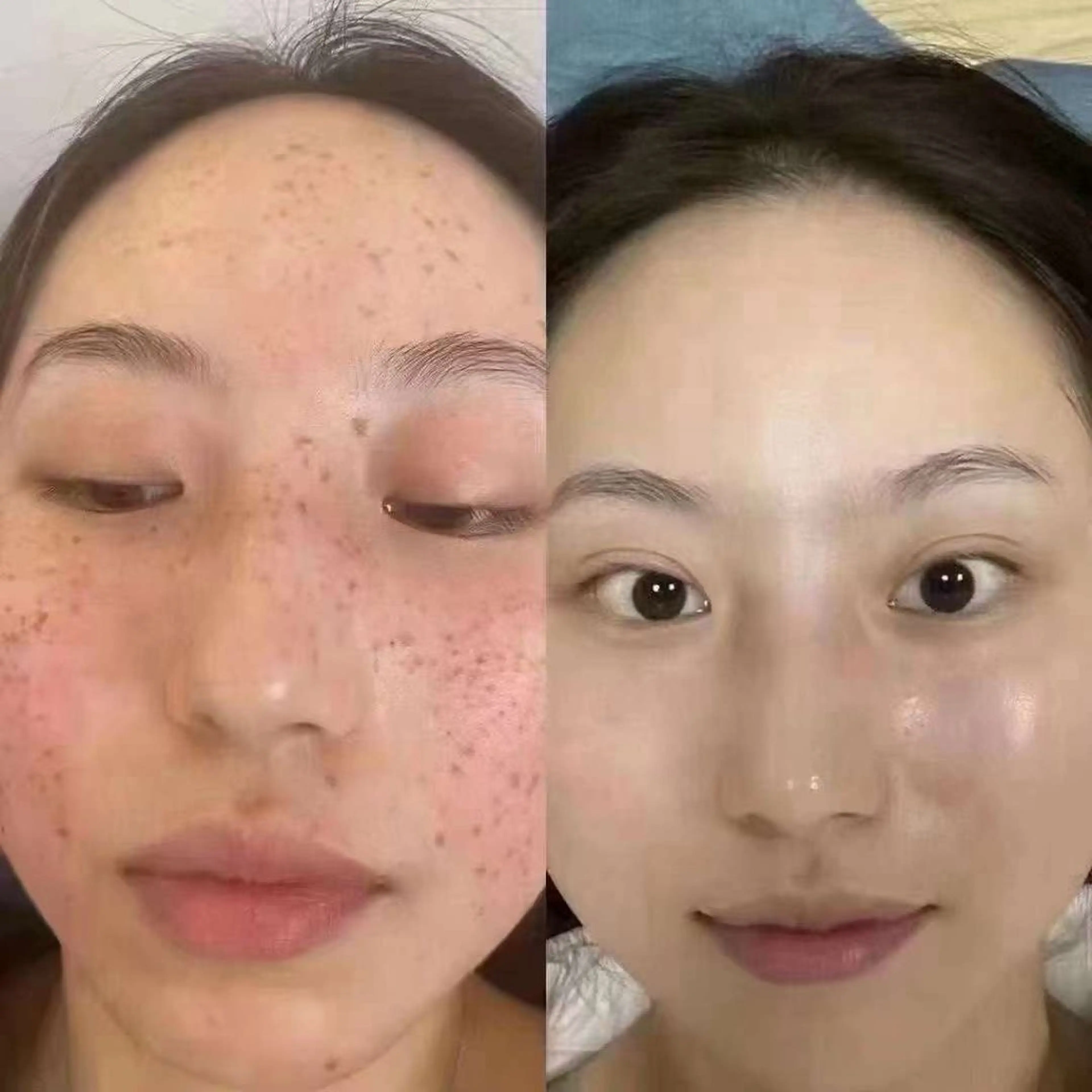 マツエク・マツパ エステ aliaハイフ&水光ジェットサロン所属・aliaハーブ水光店 エステティシャン募集のエステ・リラクイメージ