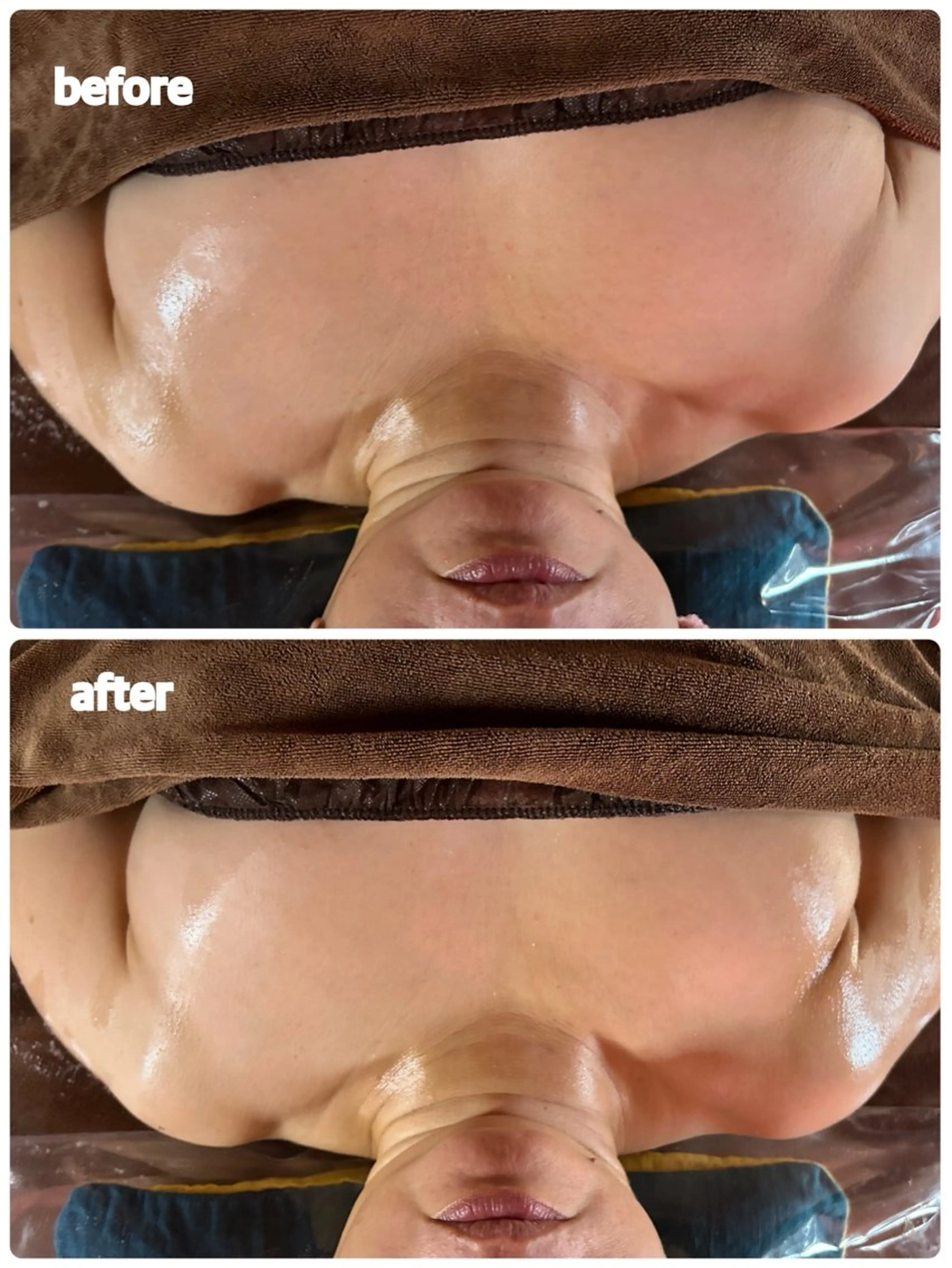 塩もみリンパマッサージ上半身(リンパ節解し・デコルテ・腕・背中)の写真