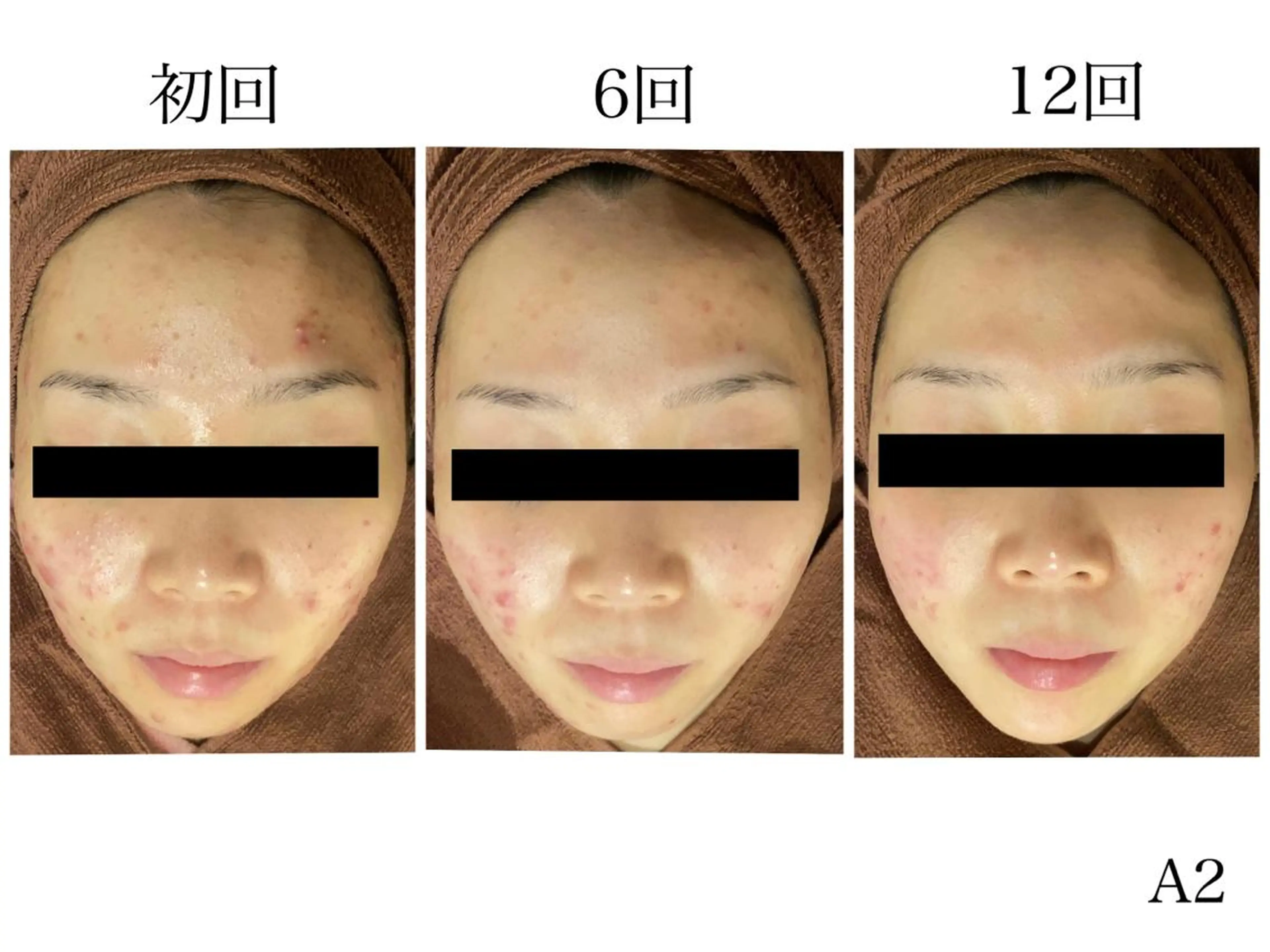 ミディアム メンズ マツエク・マツパ アイブロウ エステ リラク ニキビ・肌質改善専門 ♡人生が変わるサロンのエステ・リラクイメージ