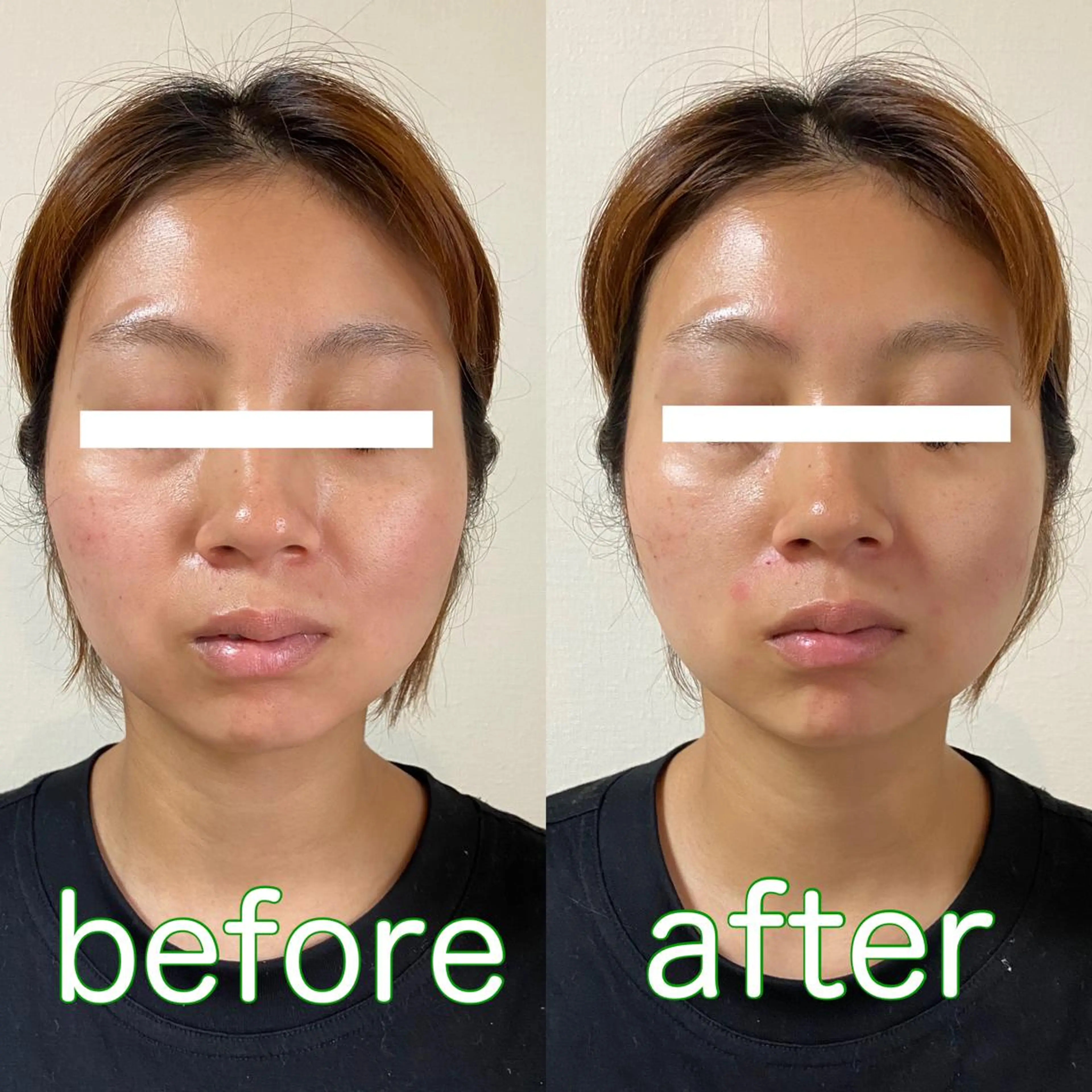 鍼灸整体院 蕾所属・美容鍼 蕾【谷町六丁目】のエステ・リラクイメージ