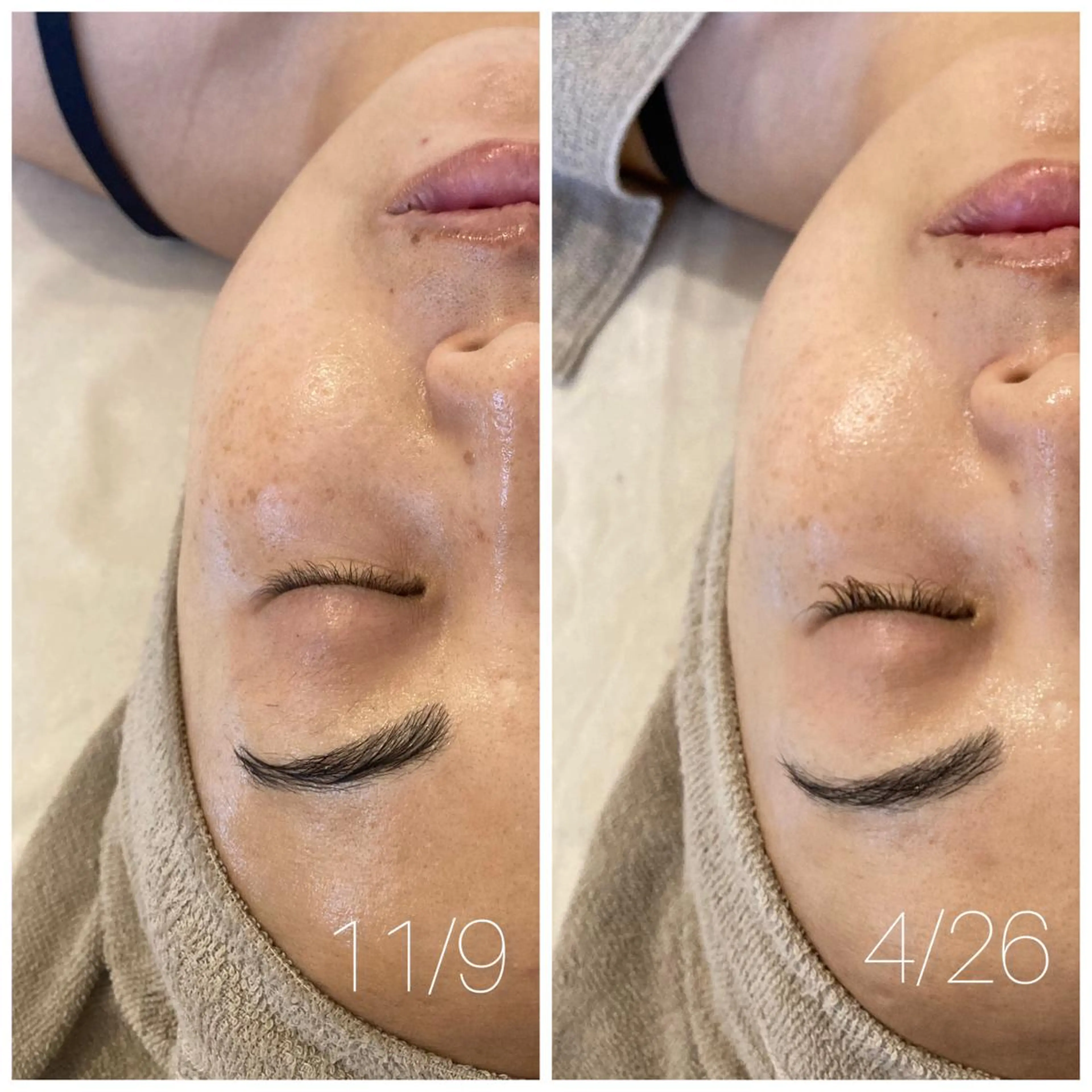 エステ Lassy keikoの眉毛・アイブロウイメージ