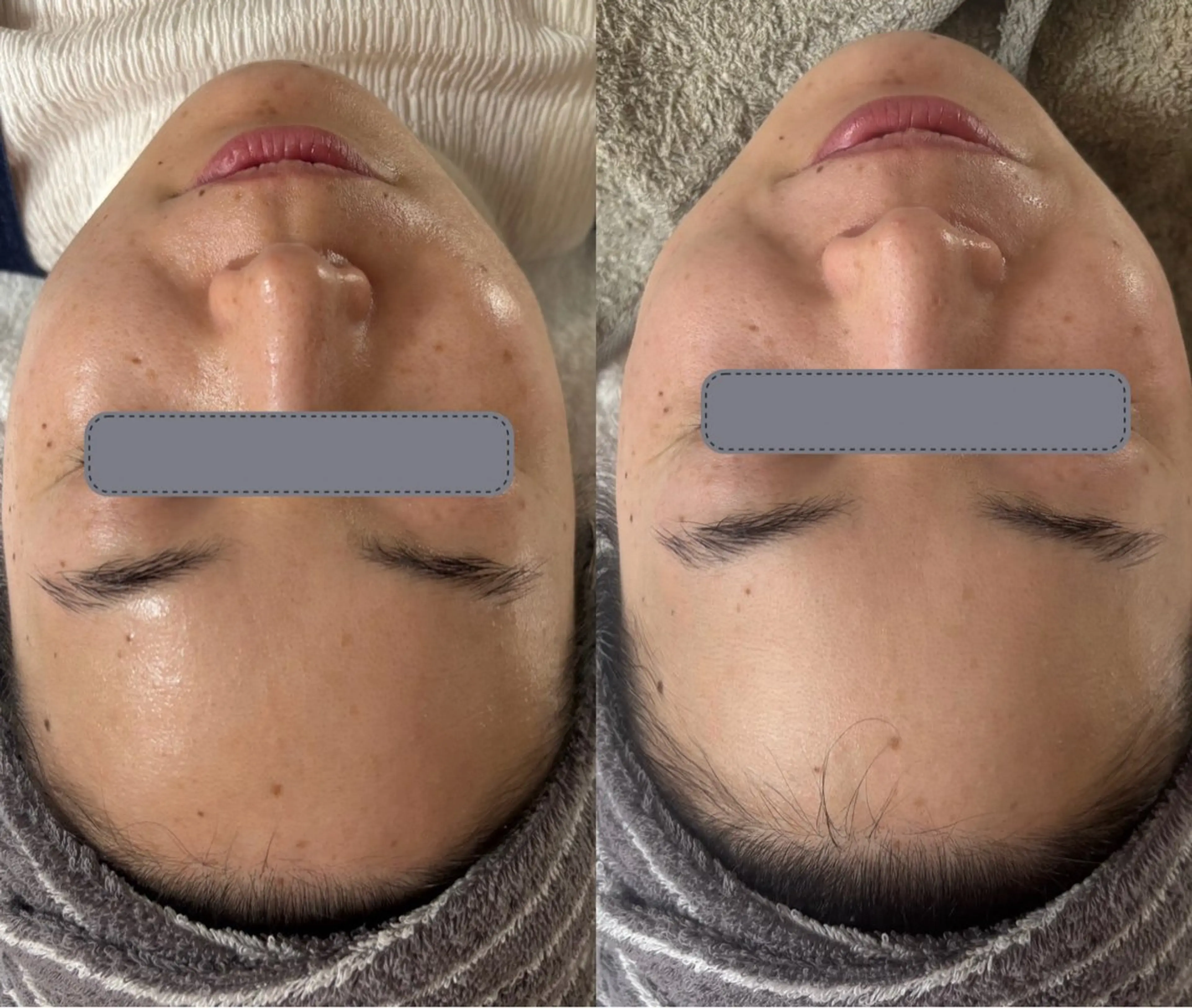 エステ リラク デアイム東広島所属・中井 小春のエステ・リラクイメージ