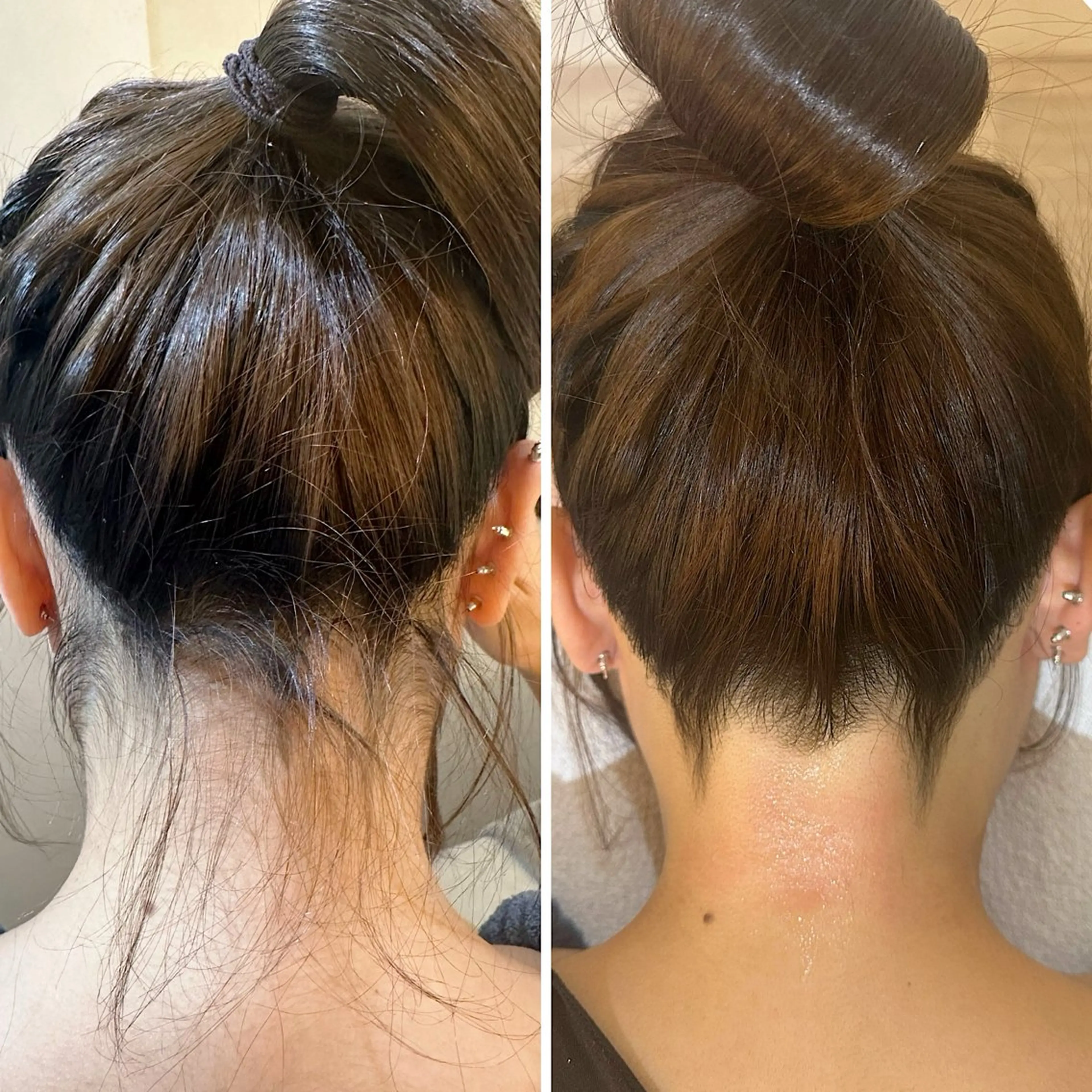 脱毛 うなじ脱毛/美肌脱毛 LABELのエステ・リラクイメージ