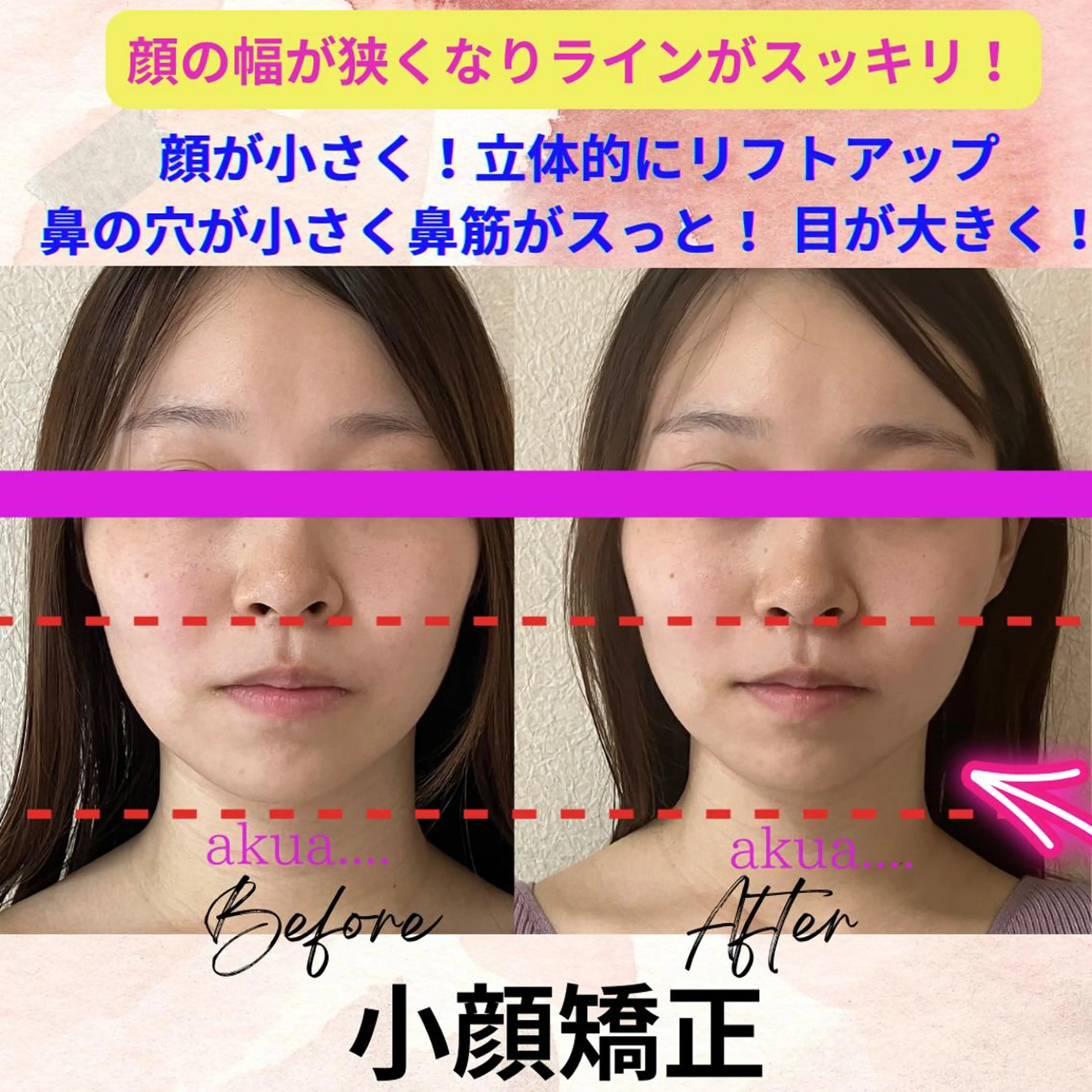 LUMINAルミナ 【肌管理サロン】のその他イメージ