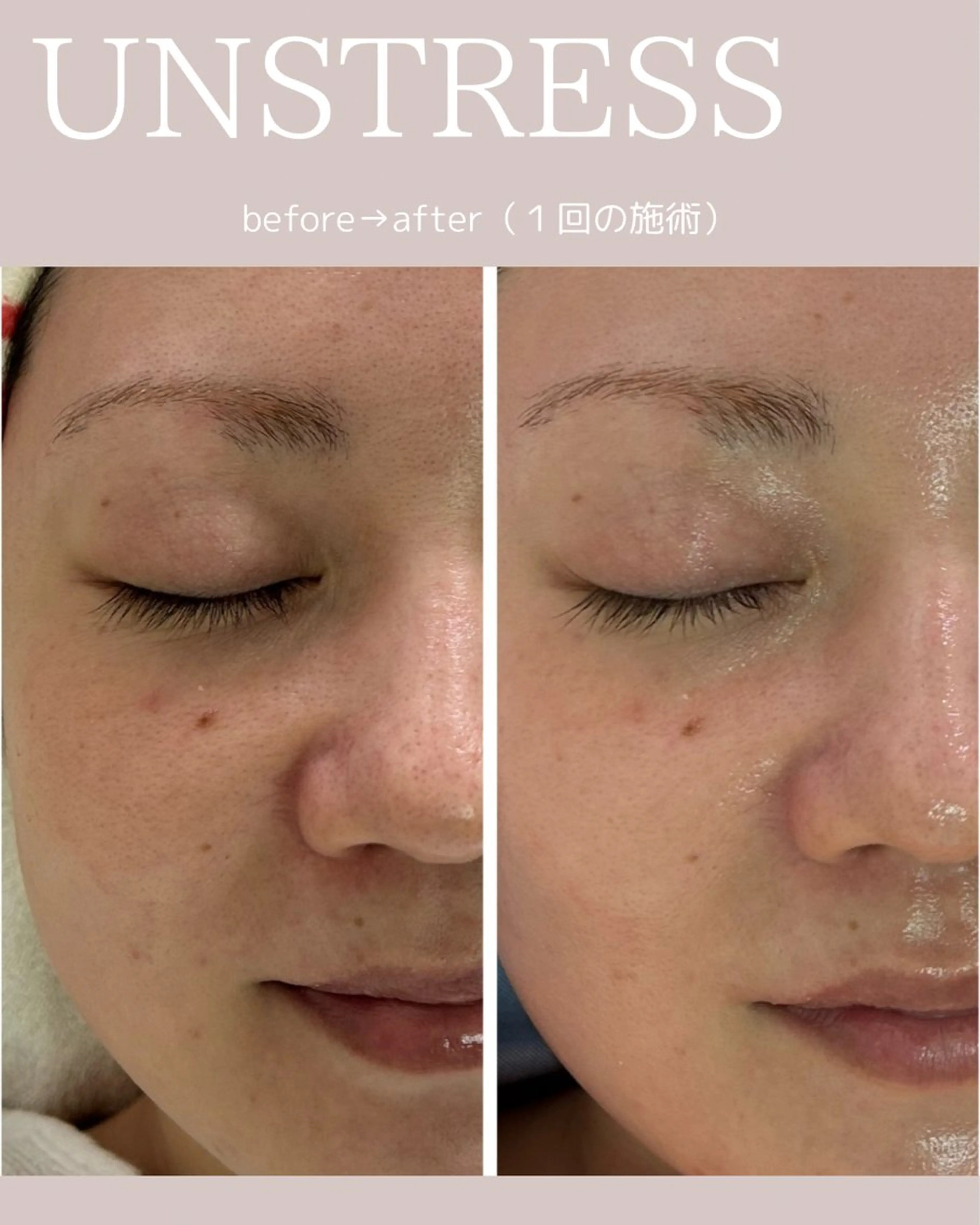 松尾 佳奈のエステ・リラクイメージ