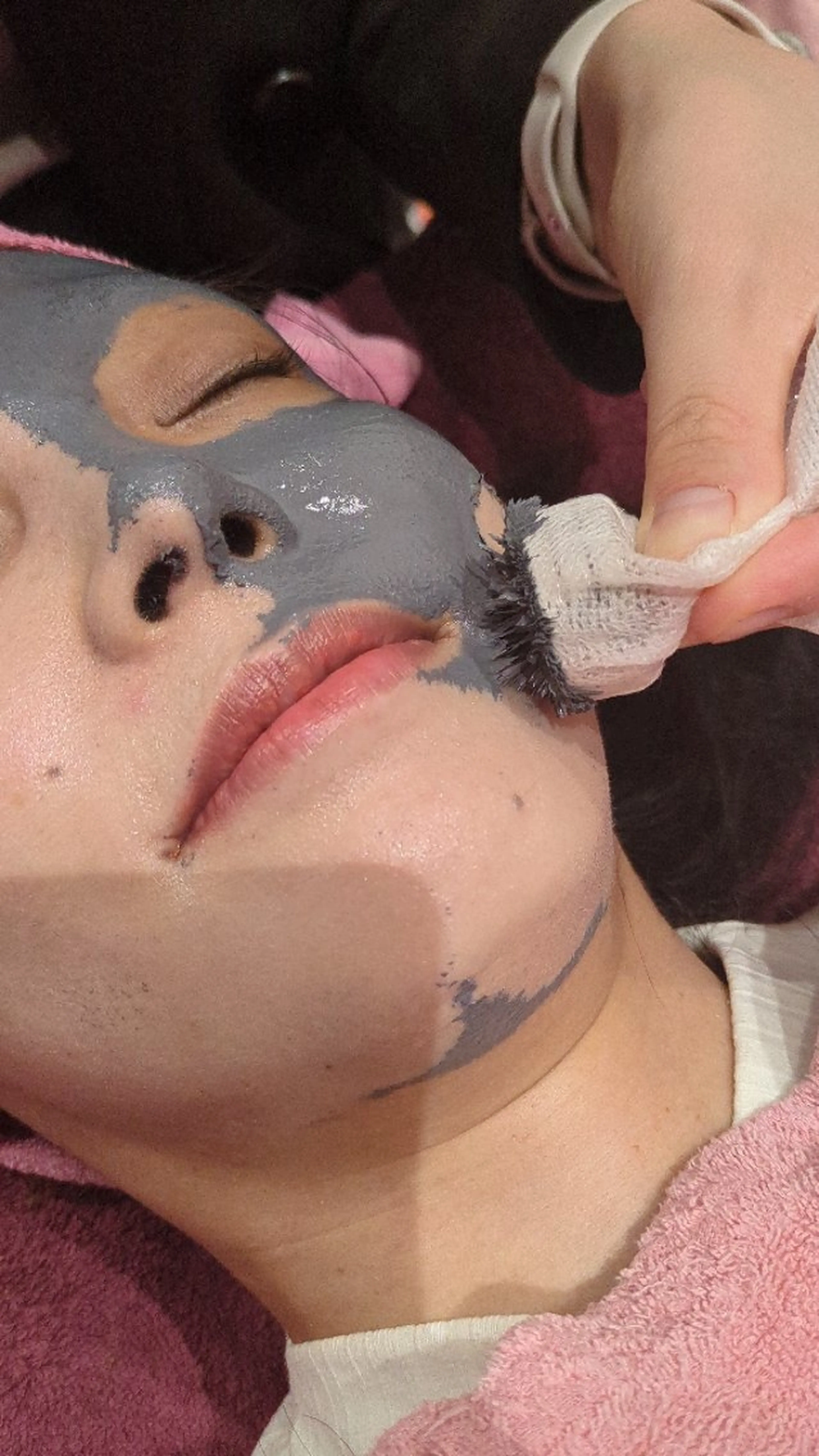 復元パックの写真