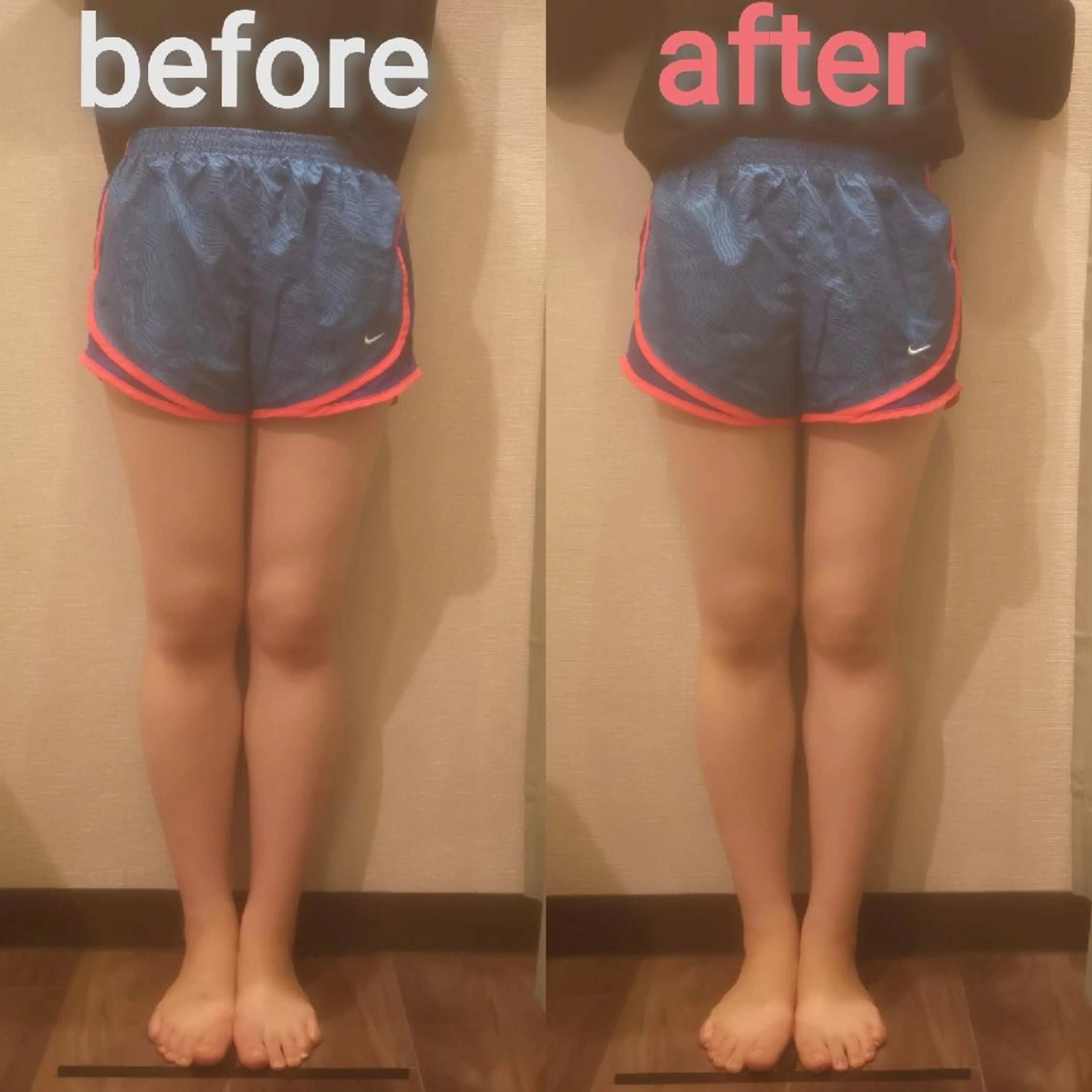 たるみ専門美容鍼 × 猫背整体 のぐち所属・小顔と姿勢改善のプロ ｜整体と美容鍼のぐちのエステ・リラクイメージ