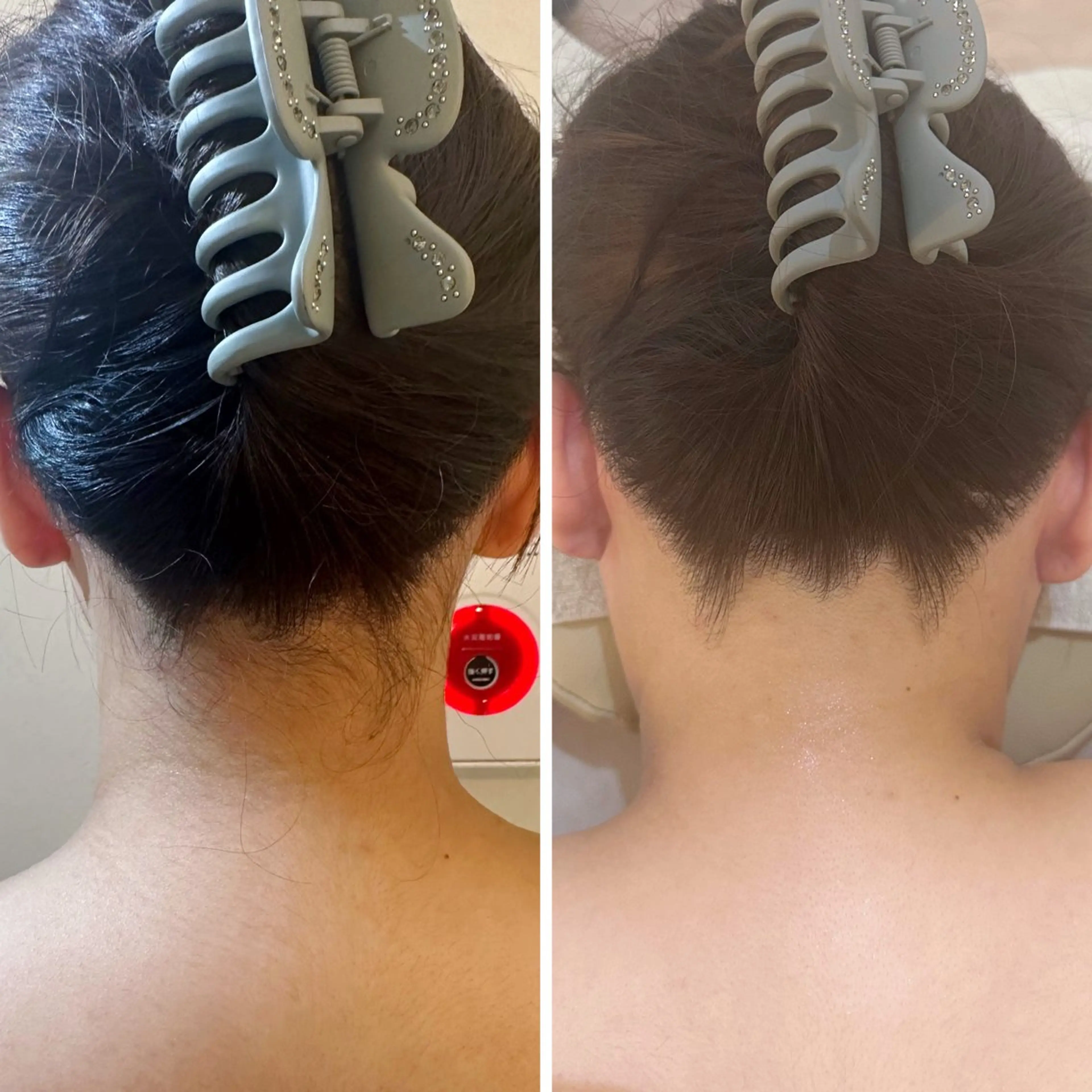 脱毛 うなじ脱毛/美肌脱毛 LABELのエステ・リラクイメージ