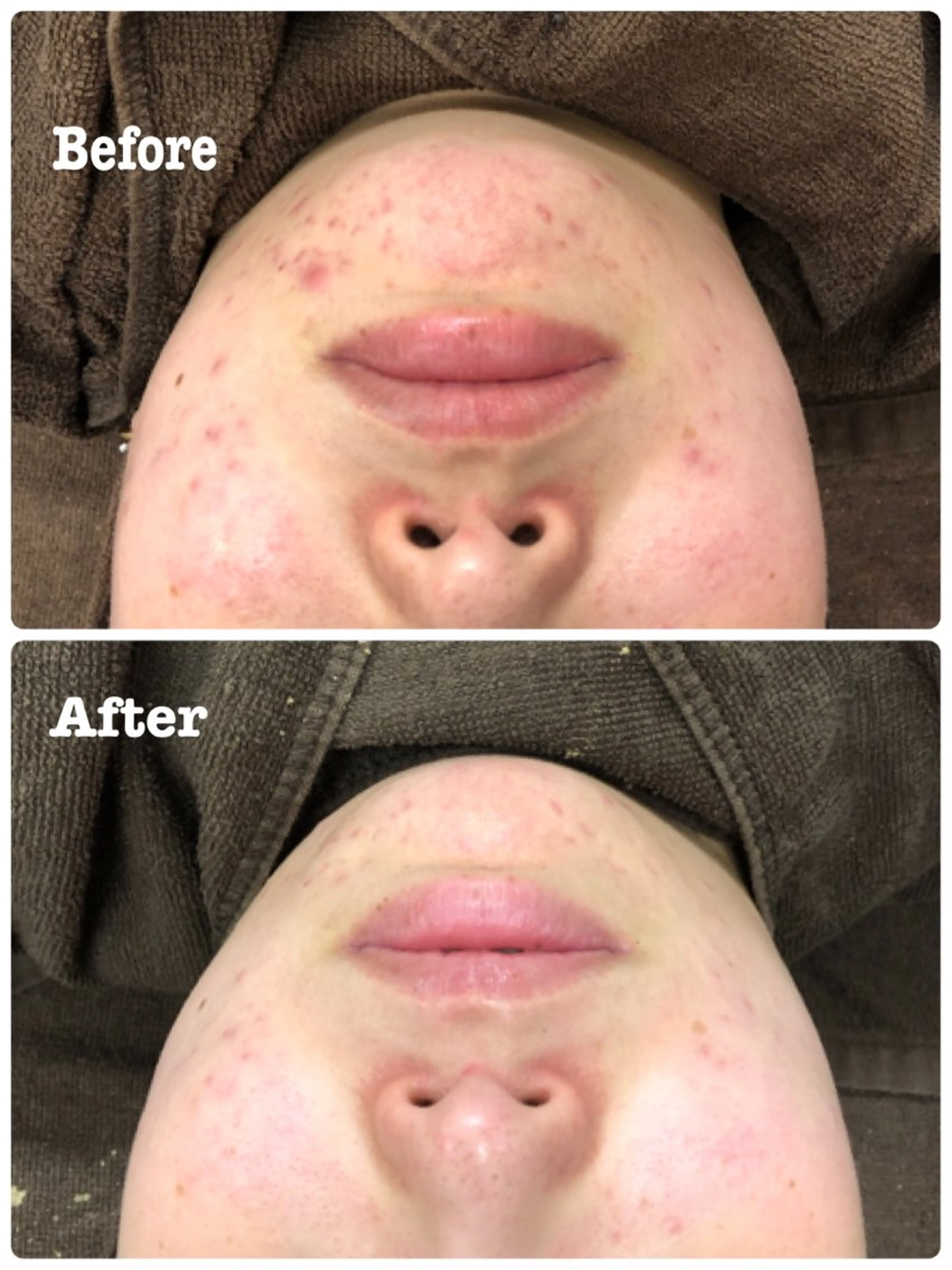 エステ 肌質改善サロン La Divinaのエステ・リラクイメージ