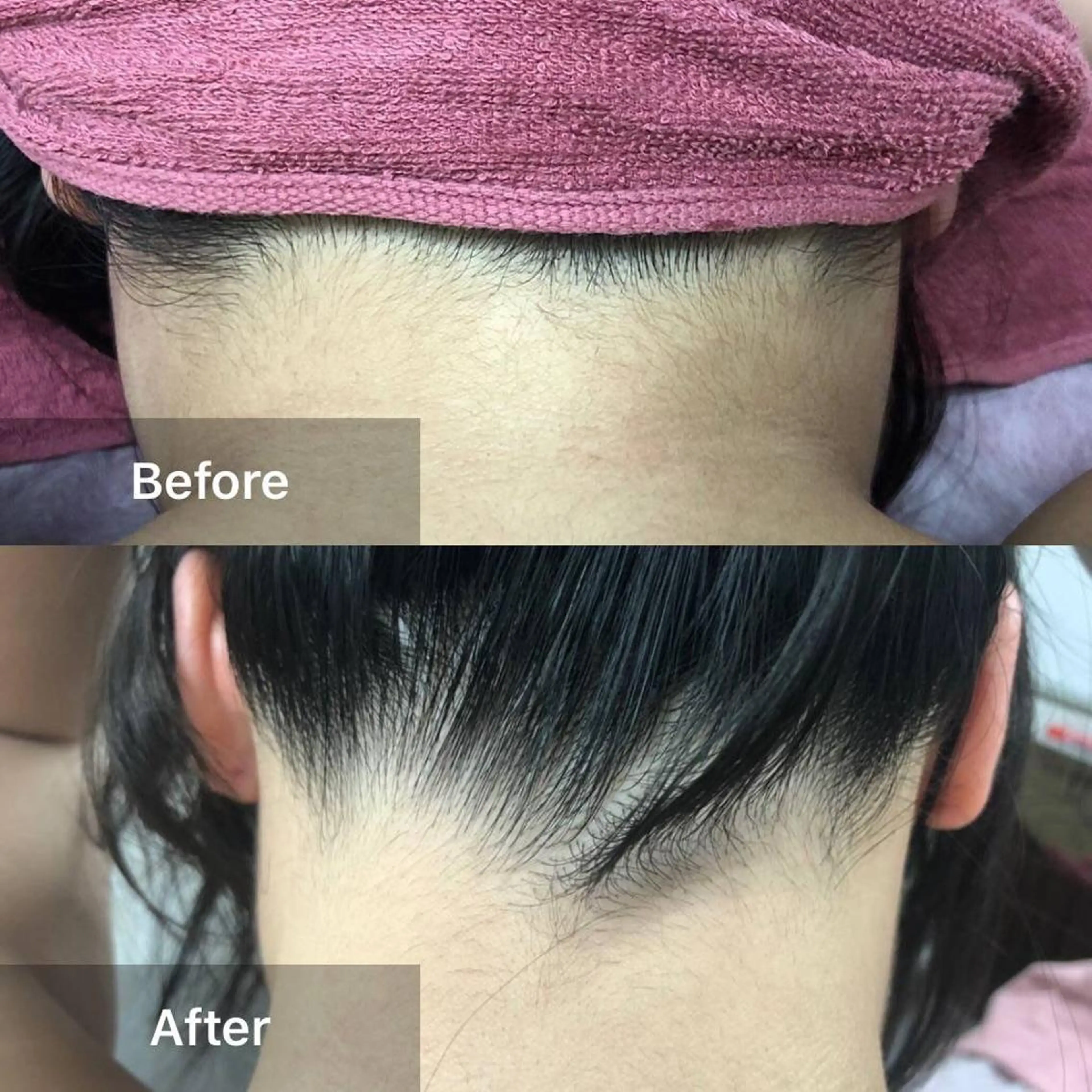 脱毛 エステ脱毛サロン Otti  オッティのエステ・リラクイメージ