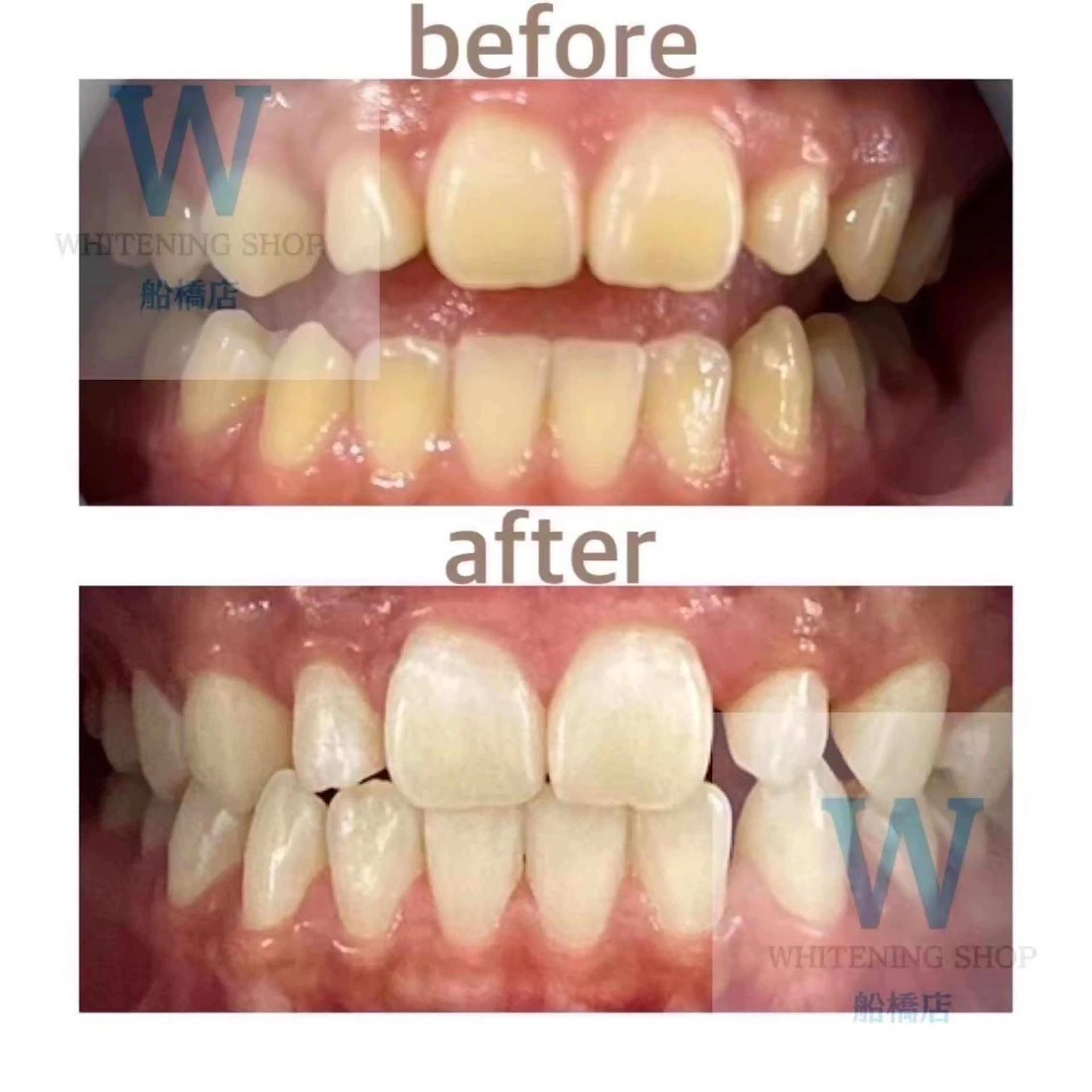 エステ リラク ホワイトニング ショップ船橋２号店のエステ・リラクイメージ