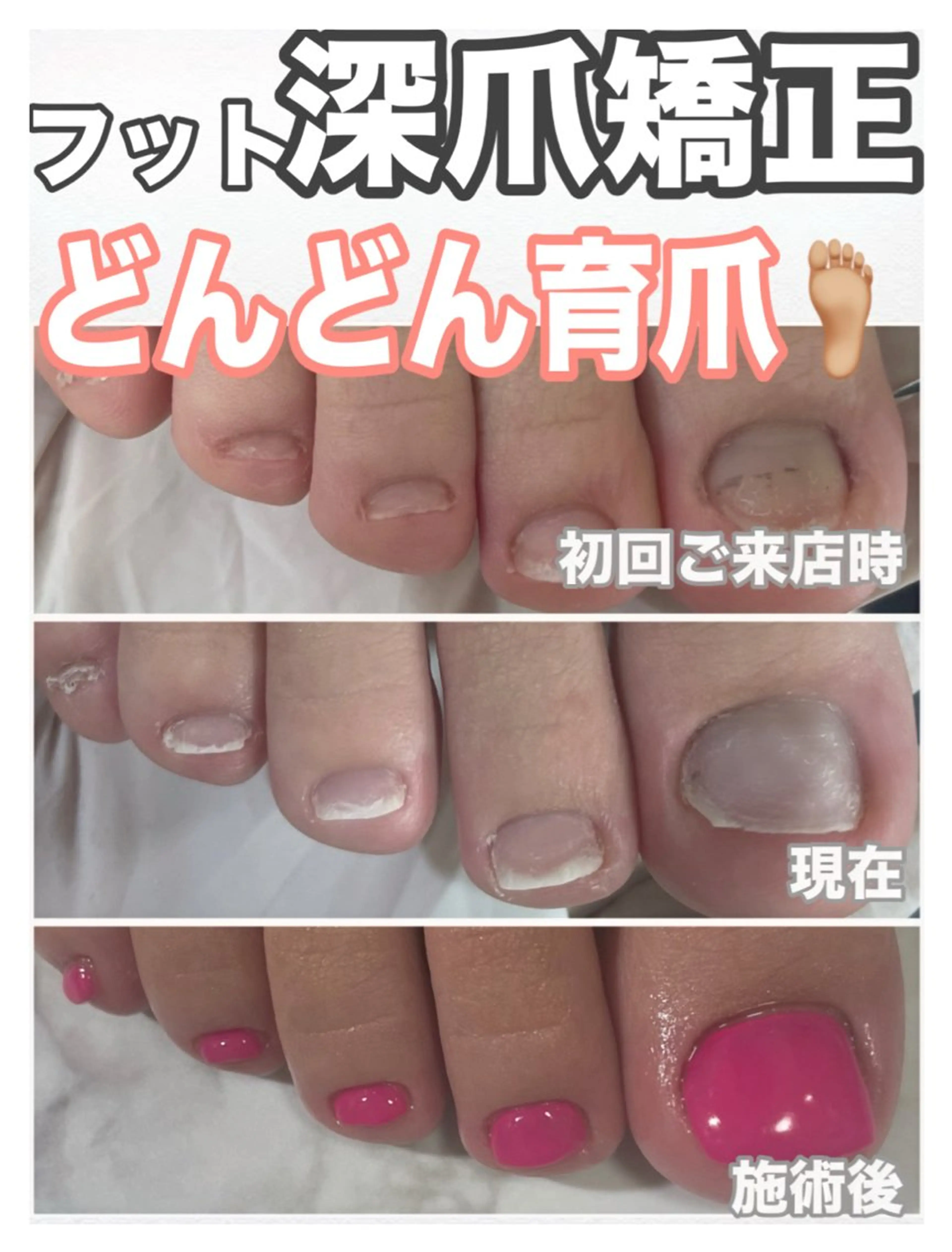 ネイル ピンク フットネイル nail salon petillantのネイルデザイン