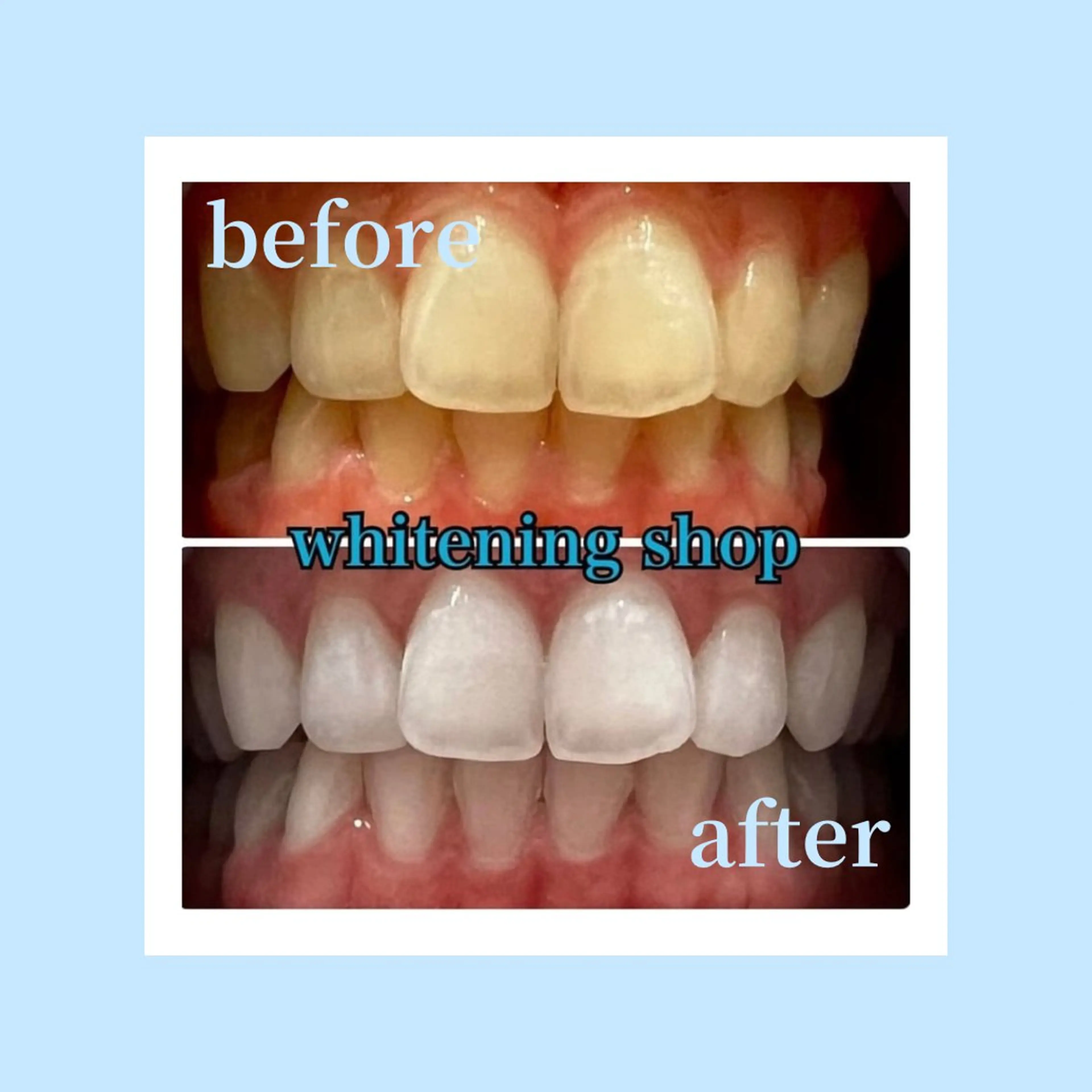 ホワイトニング ショップ光明池店のエステ・リラクイメージ