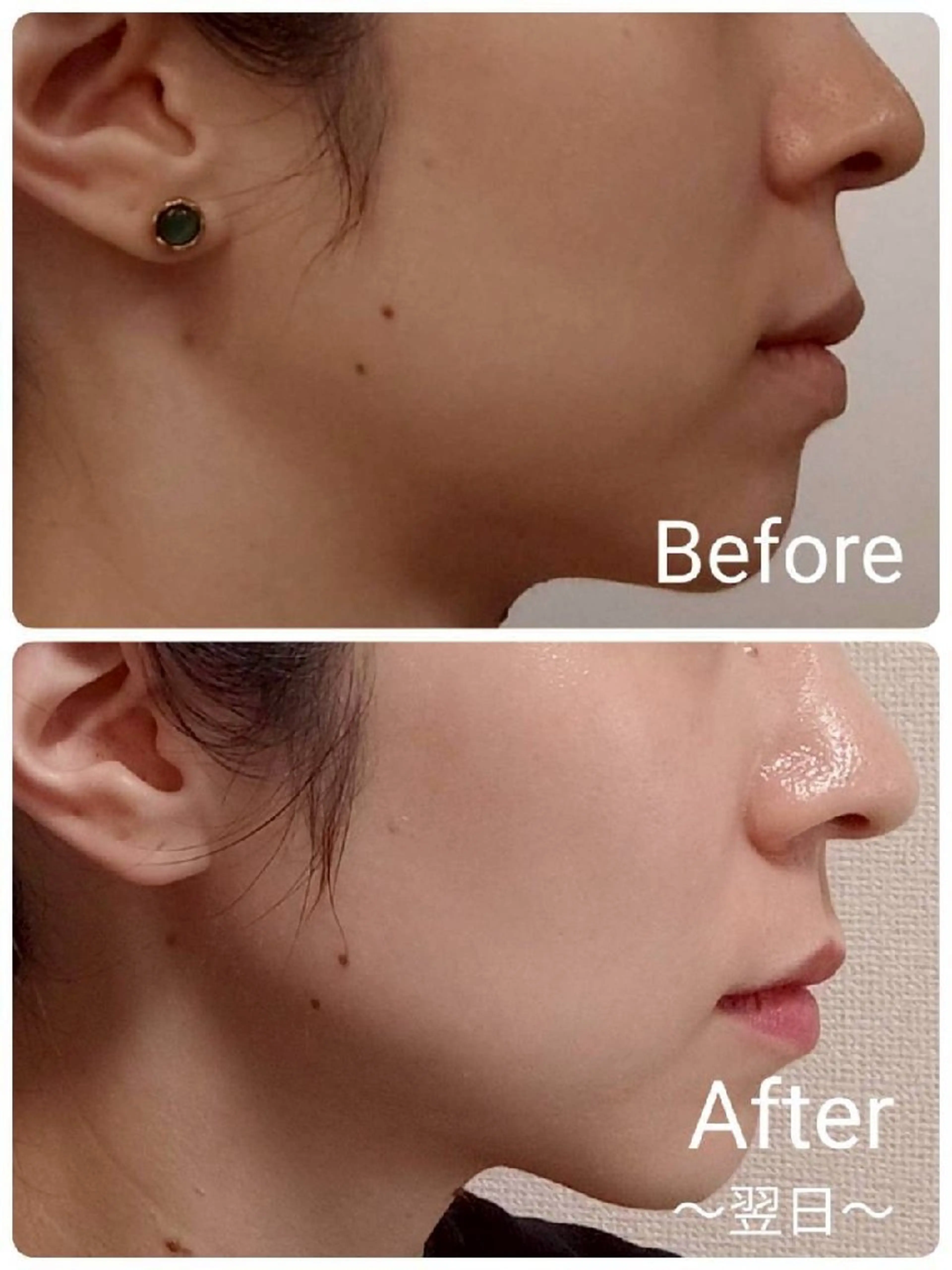 エステ リラク ICHOOSE/ 代々木上原のエステ・リラクイメージ