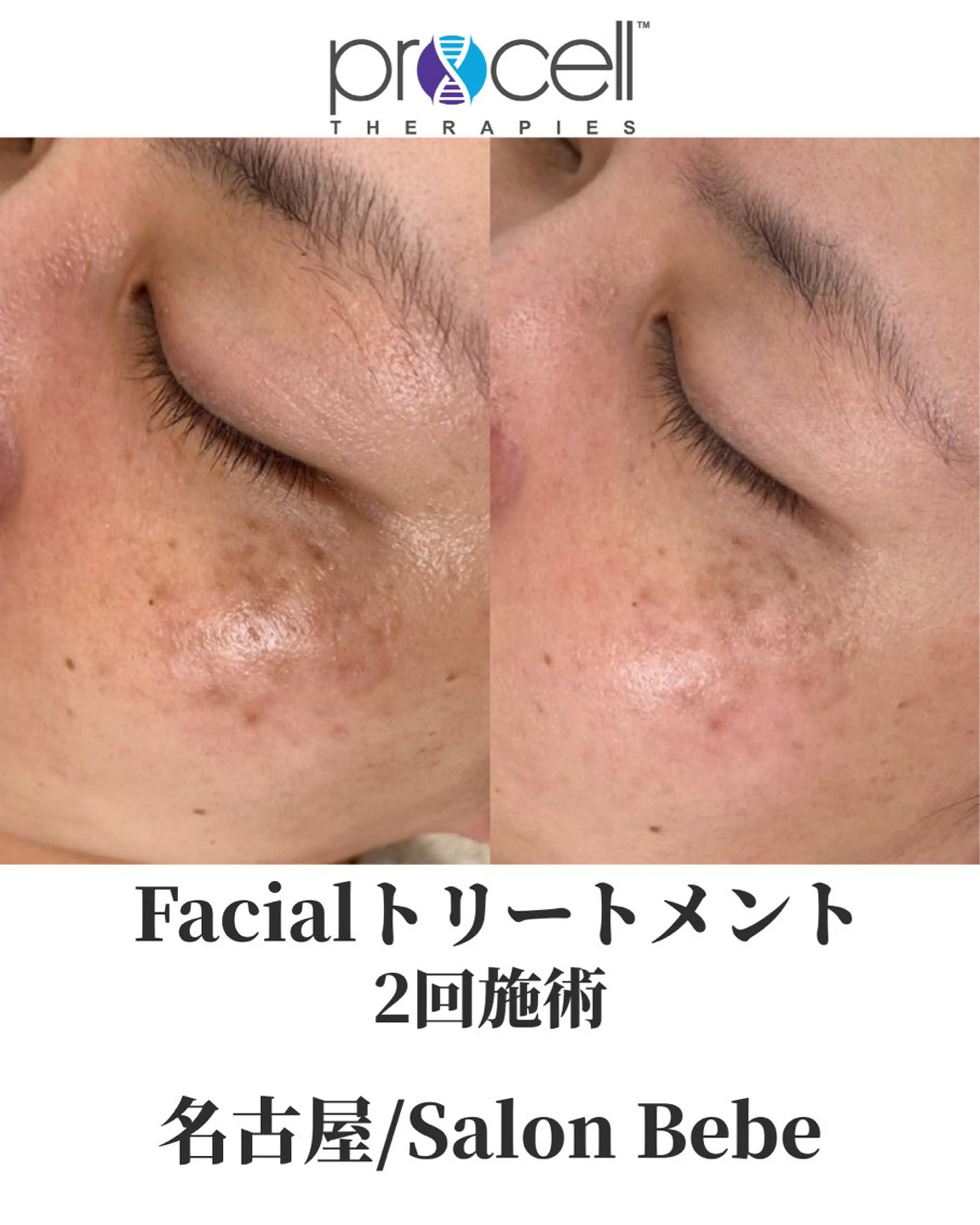 エステ Salon Bebe 名古屋のエステ・リラクイメージ