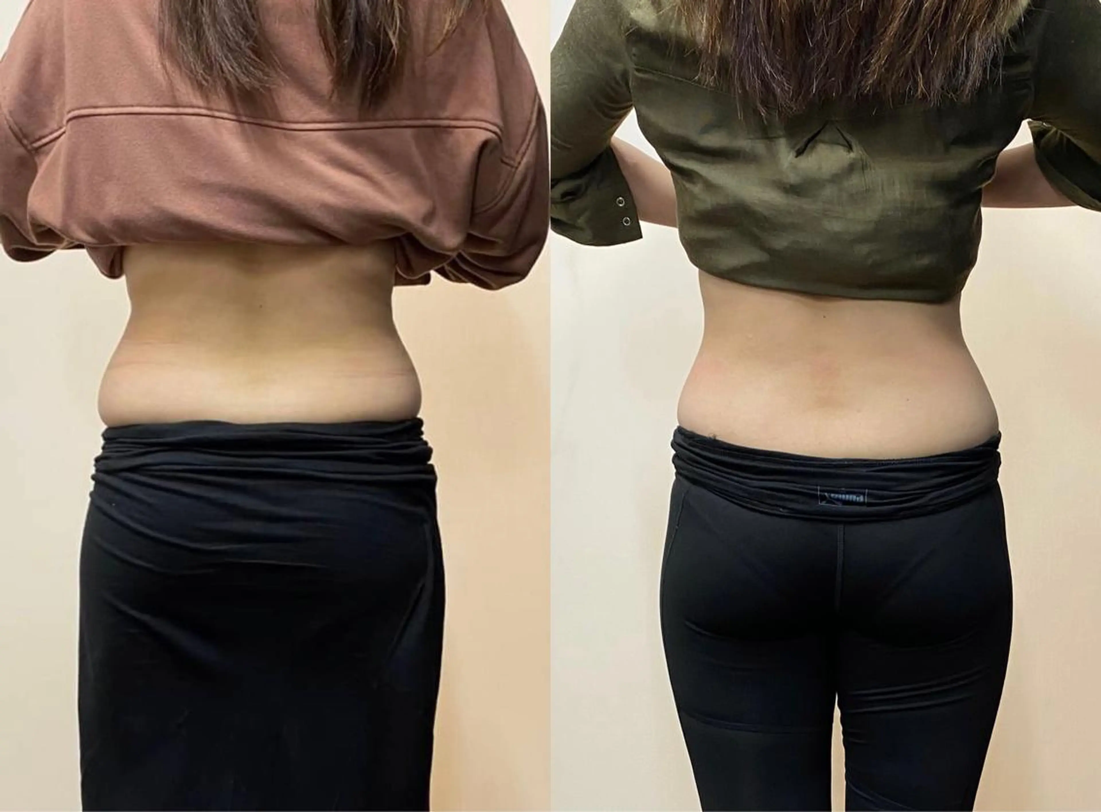 リラク clearity body care所属・クリアリティ ボディ　ケアのエステ・リラクイメージ