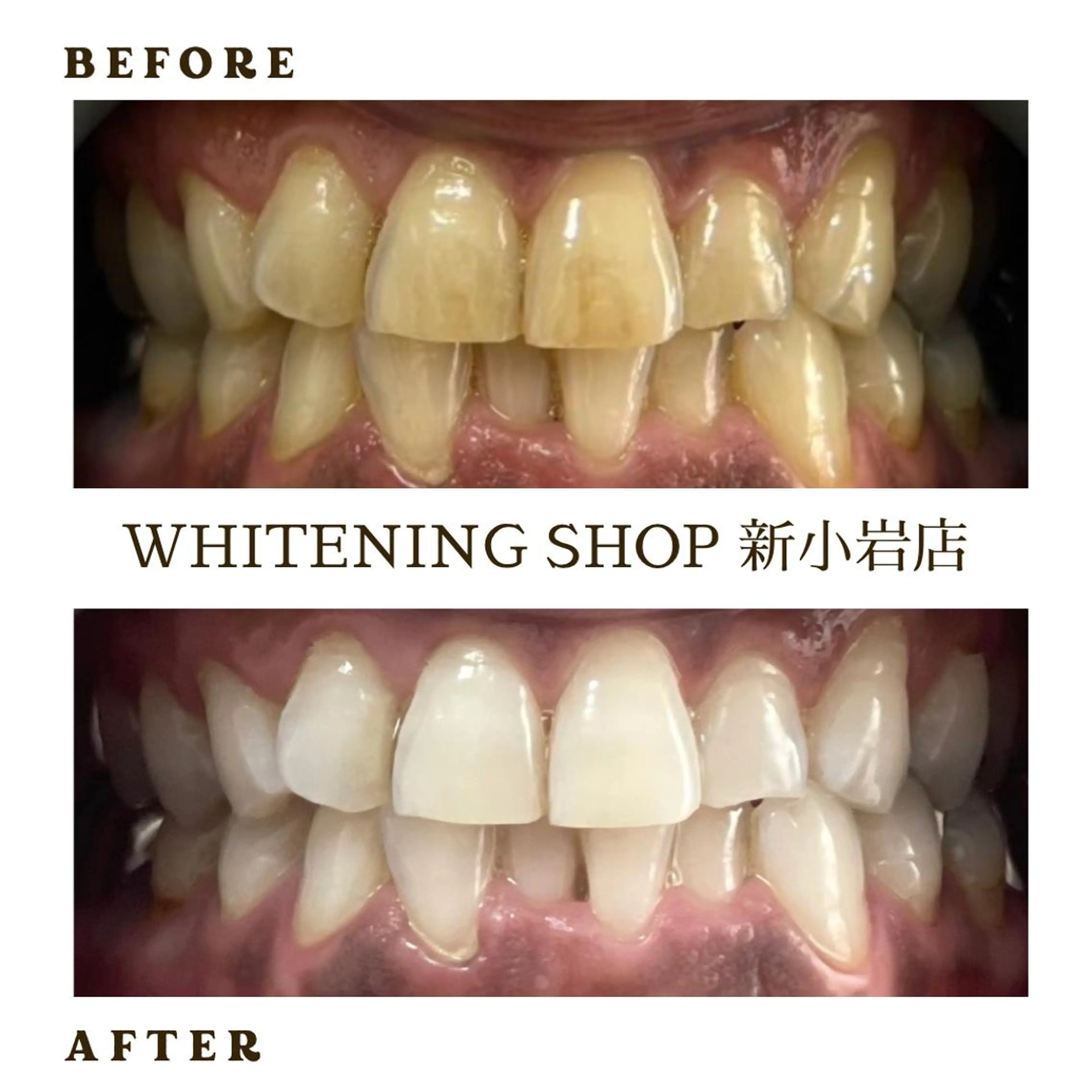 メンズ その他 ホワイトニング ショップ新小岩店のその他イメージ
