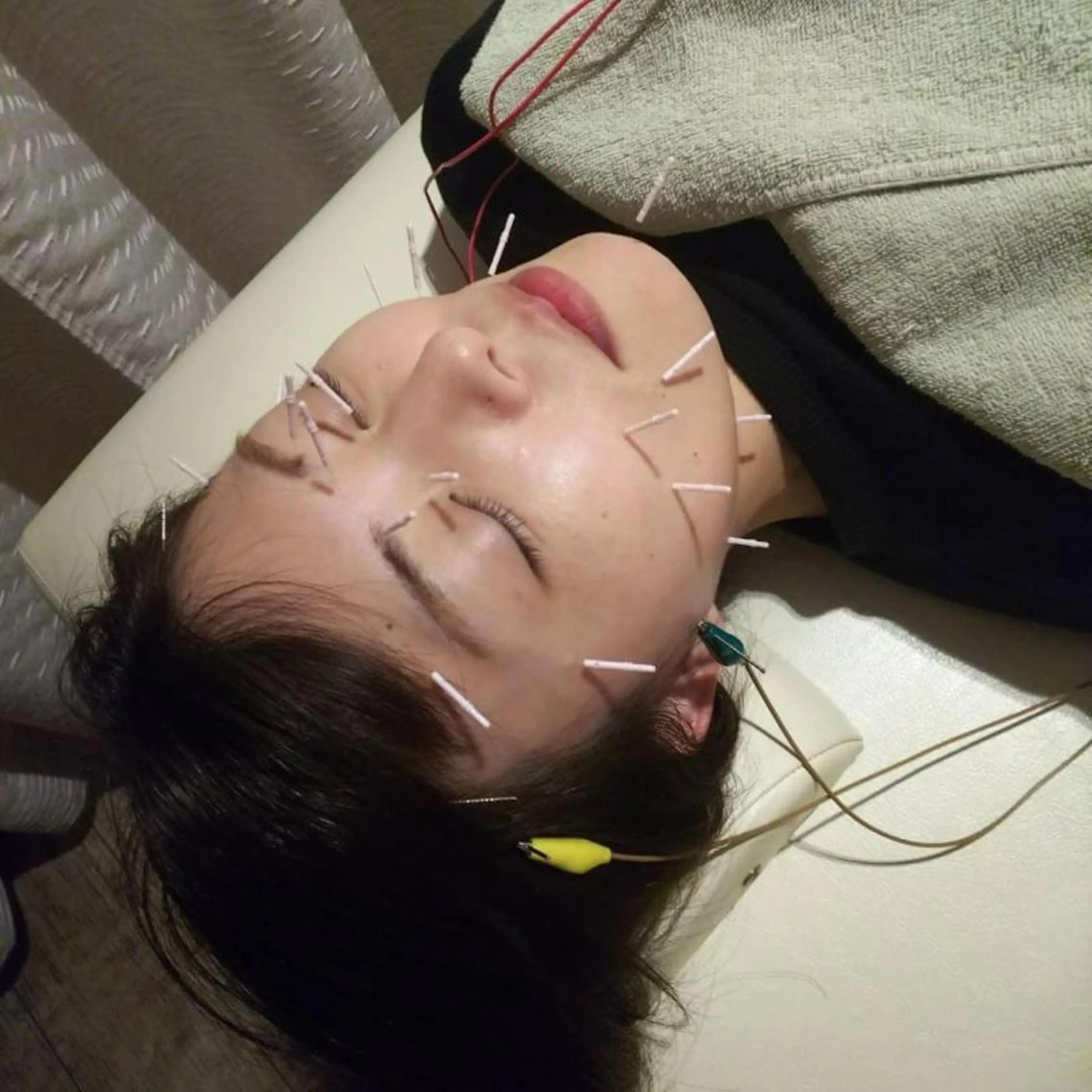 むくみたるみ専門☆ 美容鍼・小顔矯正のエステ・リラクイメージ