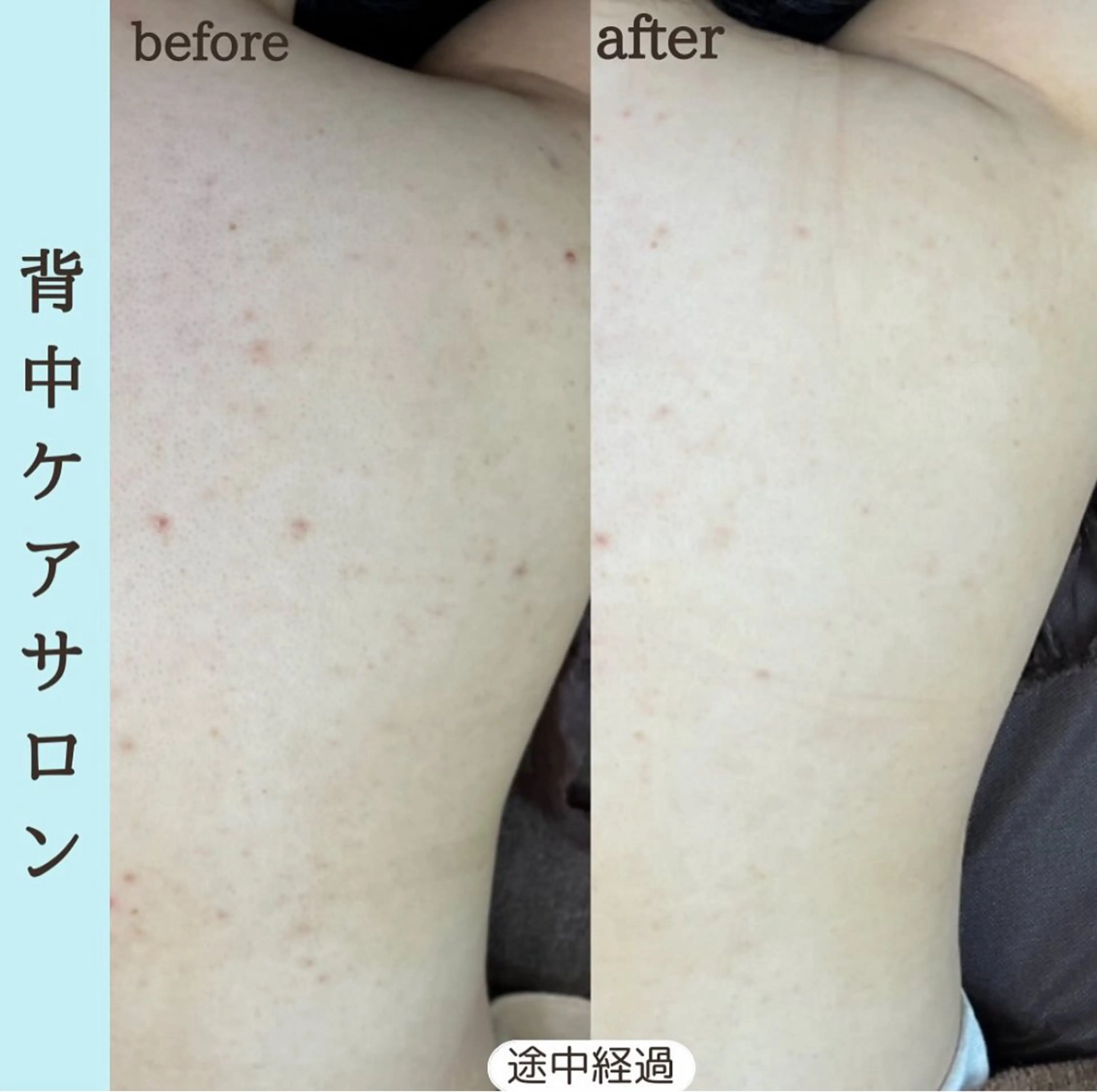 エステ ベラージュ【美背中・ 美尻・フェイシャル】のエステ・リラクイメージ