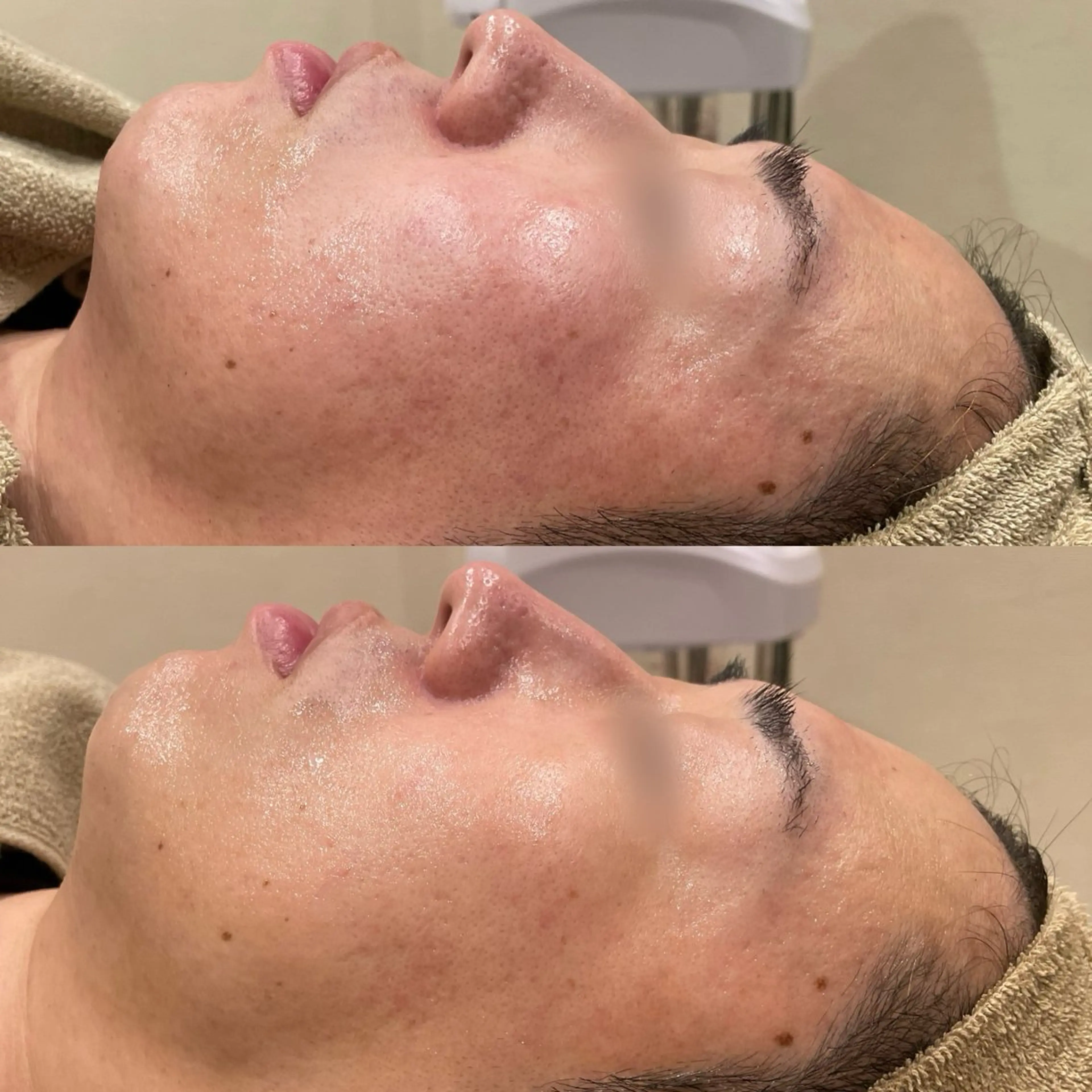 エステ Re:Belle 久留米 : 中島のエステ・リラクイメージ