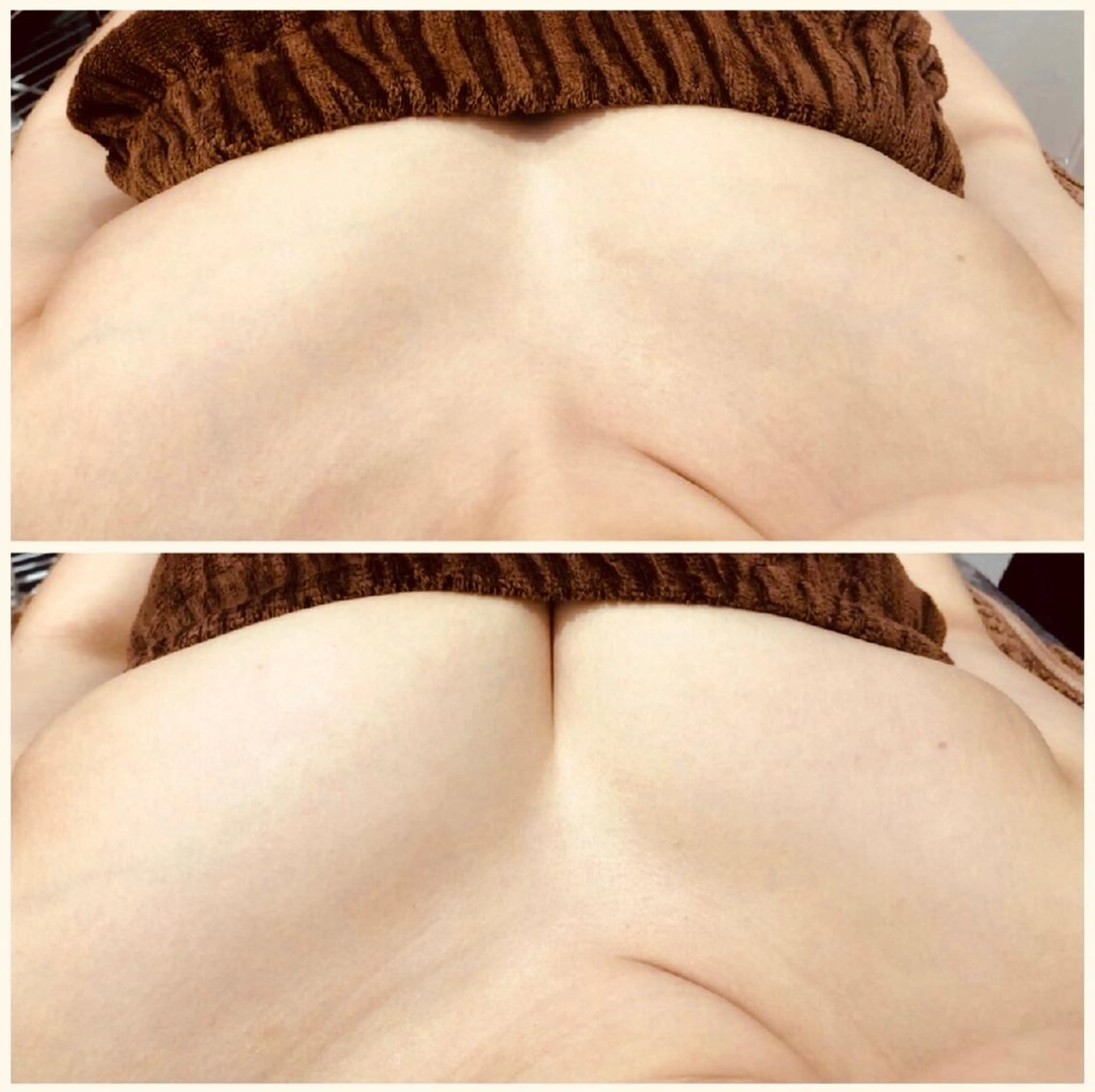 エステ バストアップサロン 「パトラクシェ本店」のエステ・リラクイメージ