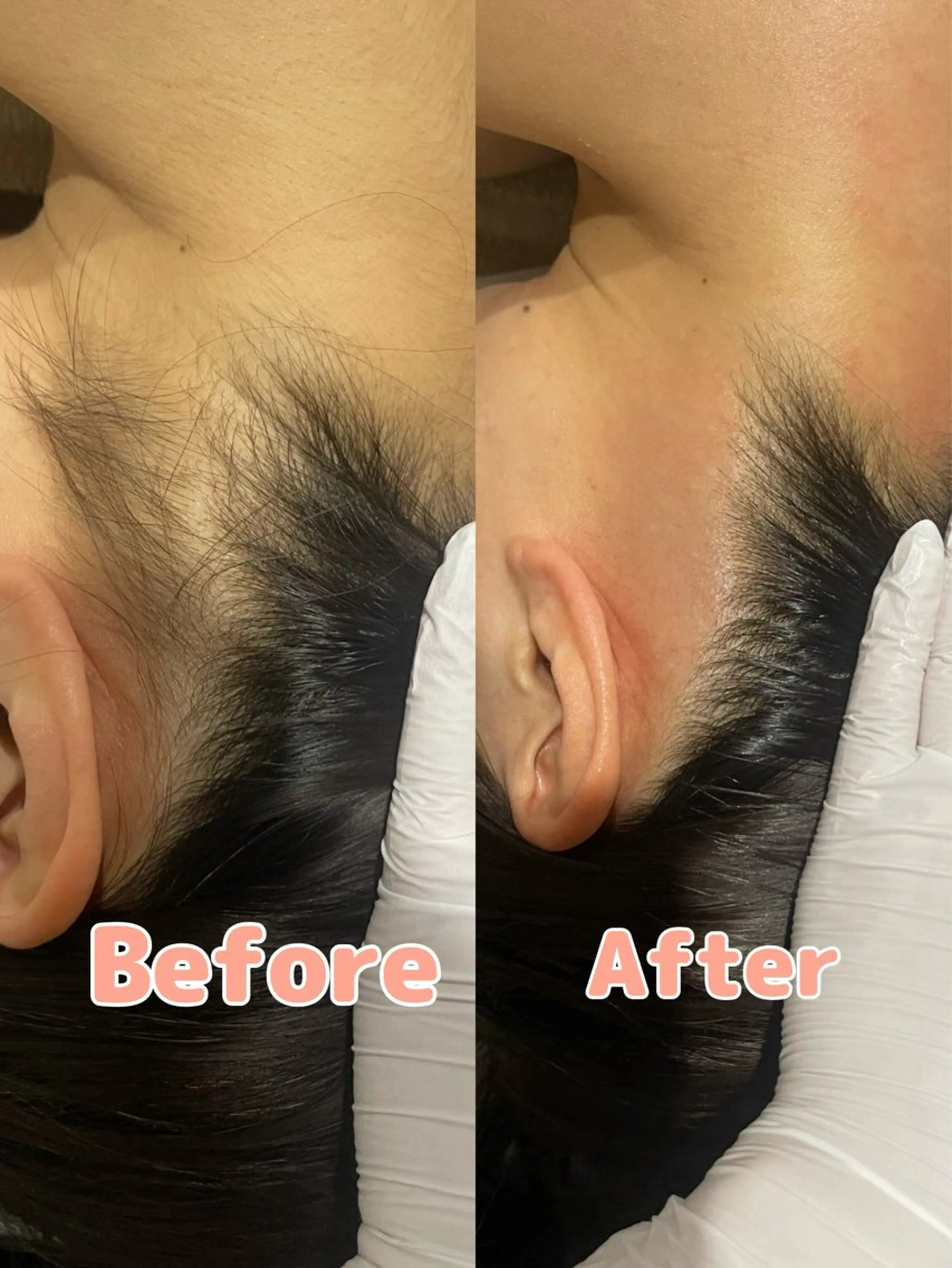 脱毛＆小顔コルギ 専門店 Lucirのエステ・リラクイメージ