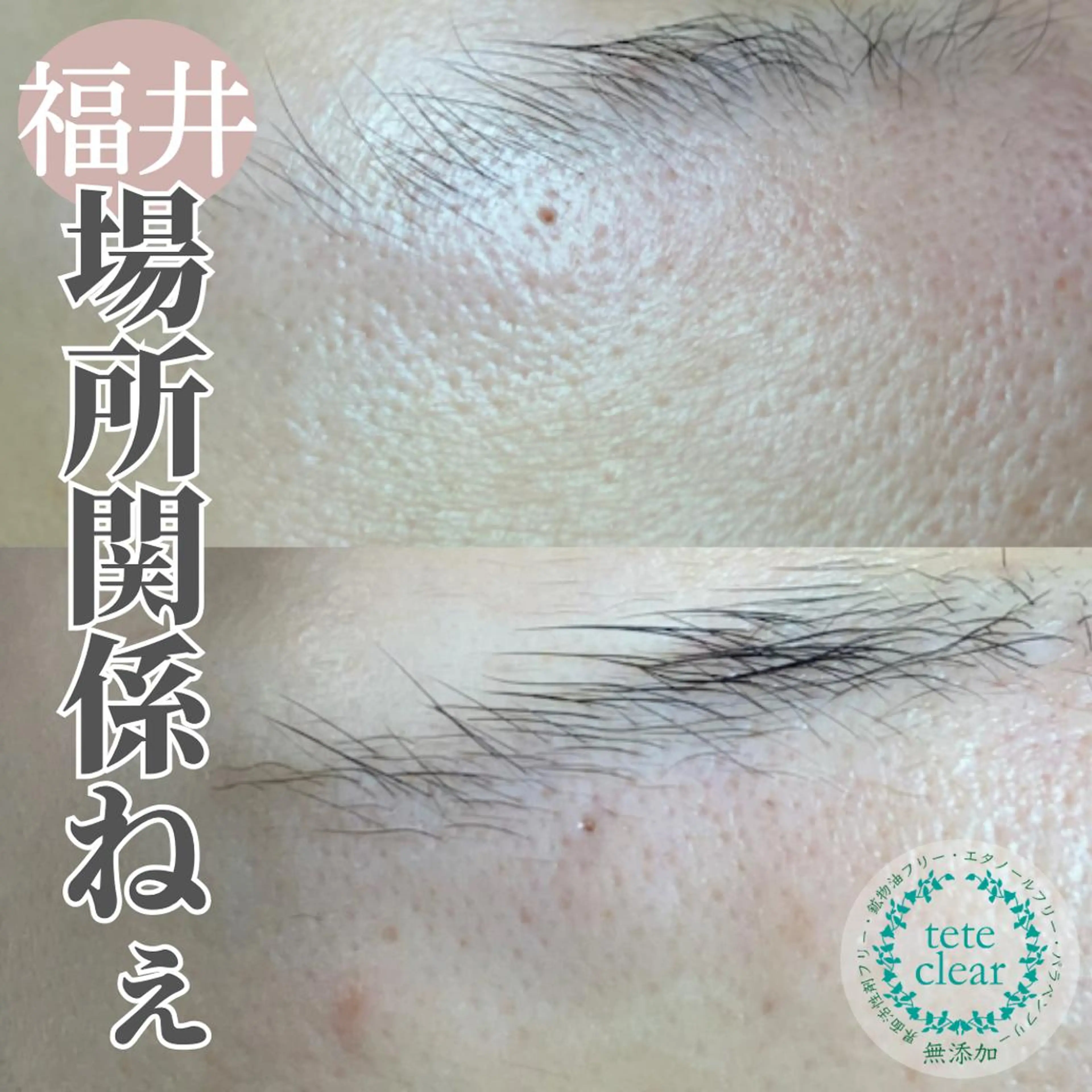 毛穴肌質ケアサロン Yourmeユアミーのエステ・リラクイメージ