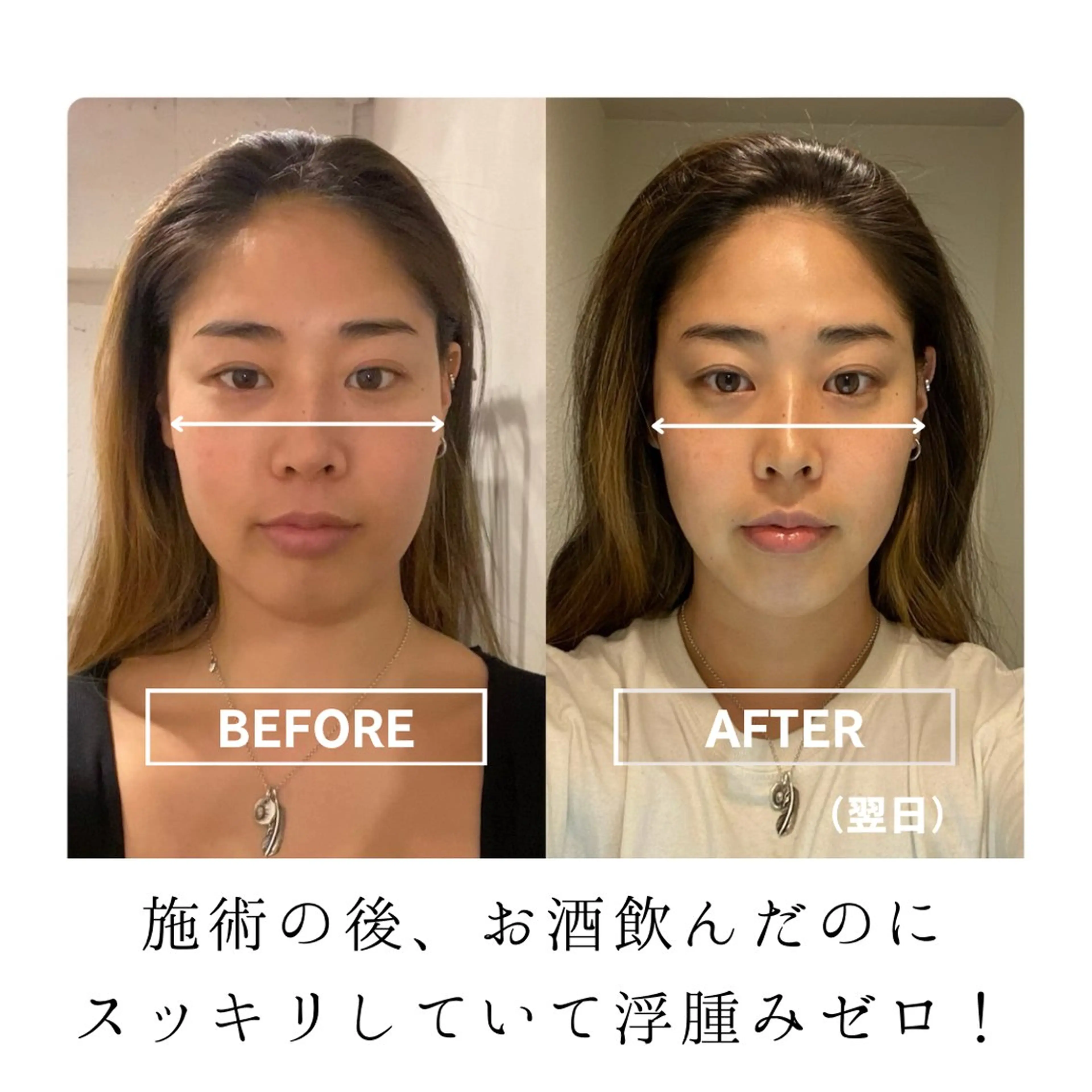 小顔矯正サロン AYURのエステ・リラクイメージ