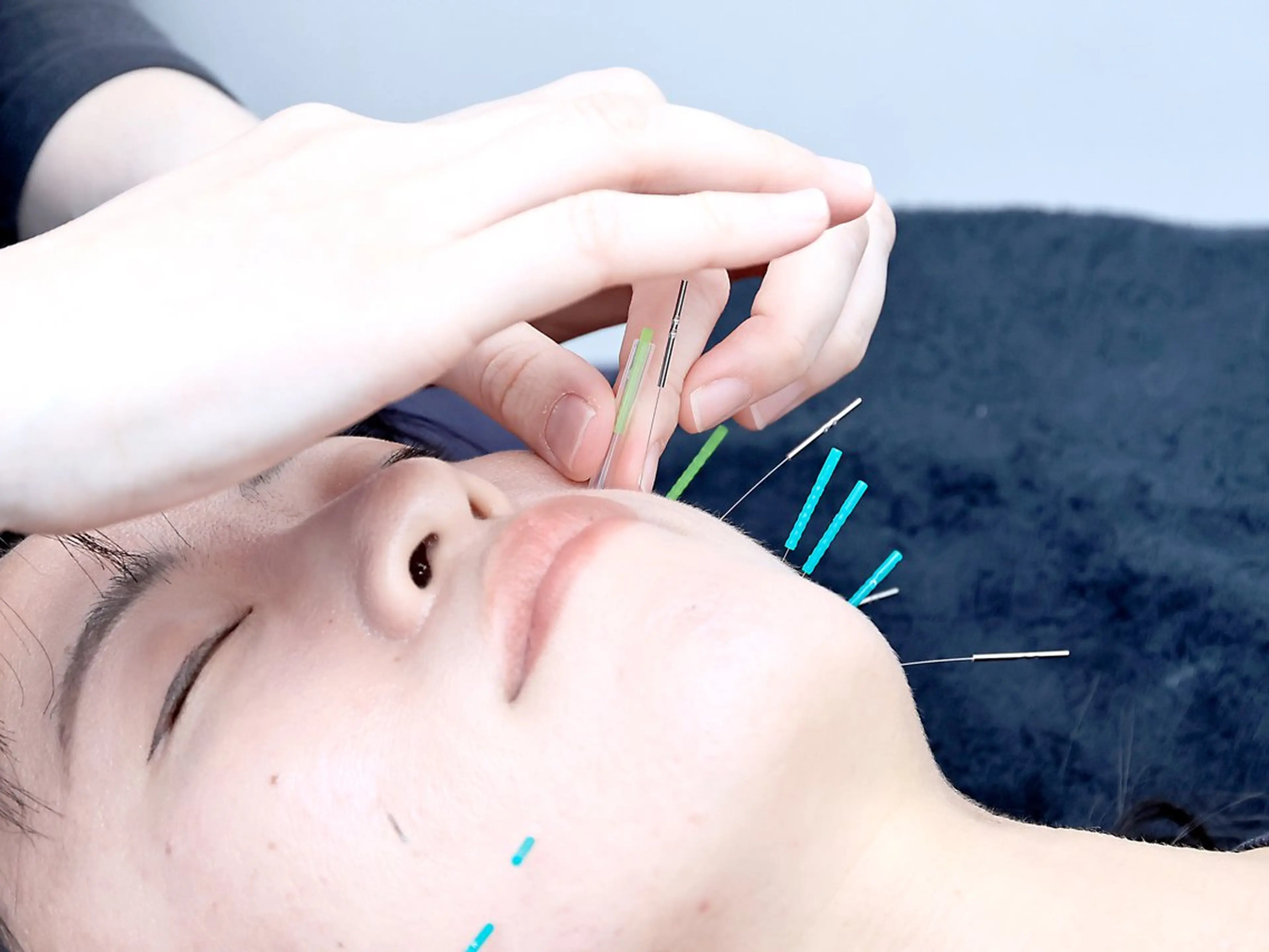 美容鍼・小顔矯正 FLOW 鍼灸整体院のその他イメージ