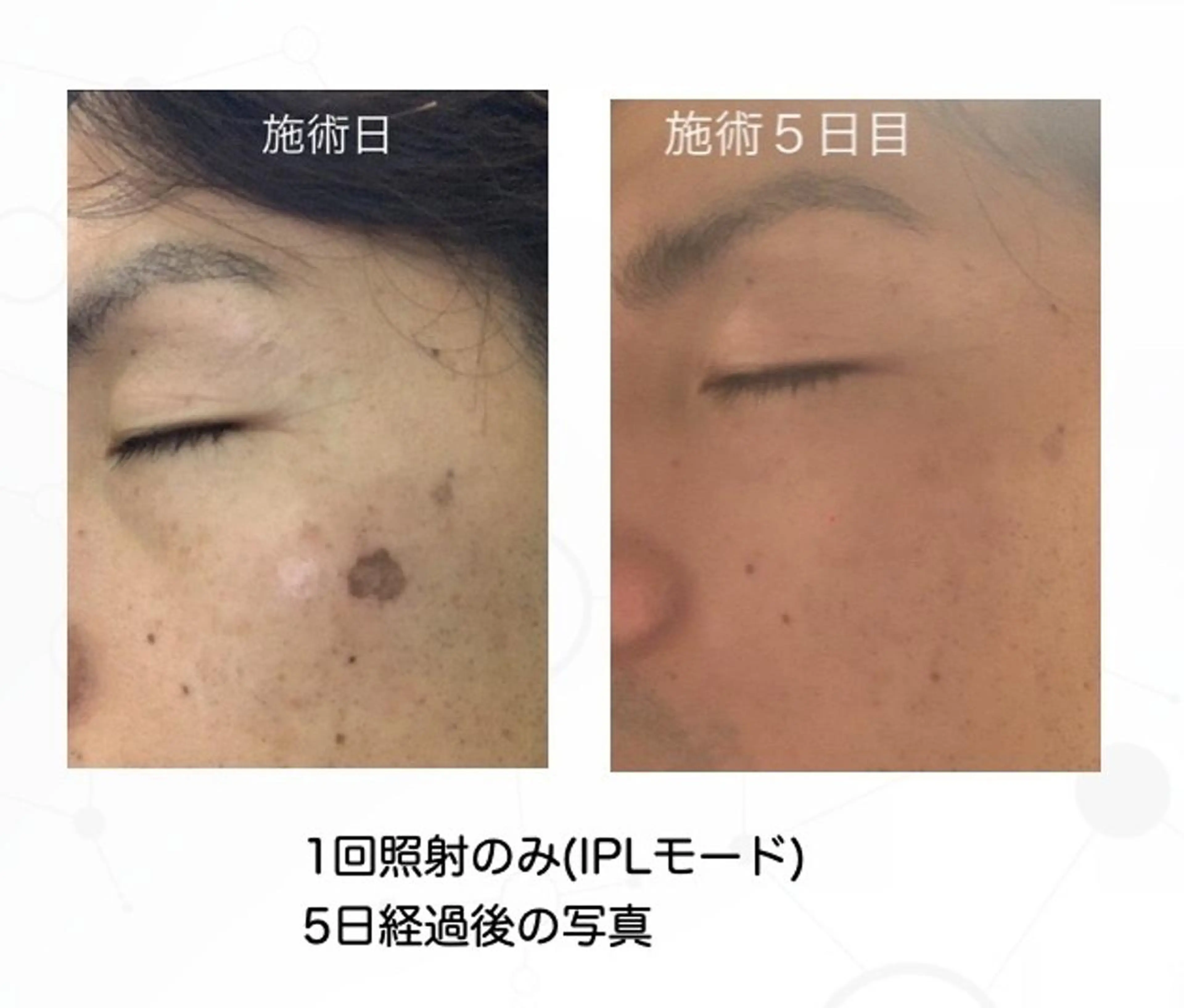 Felice🌸脱毛 ・光フェイシャルのエステ・リラクイメージ