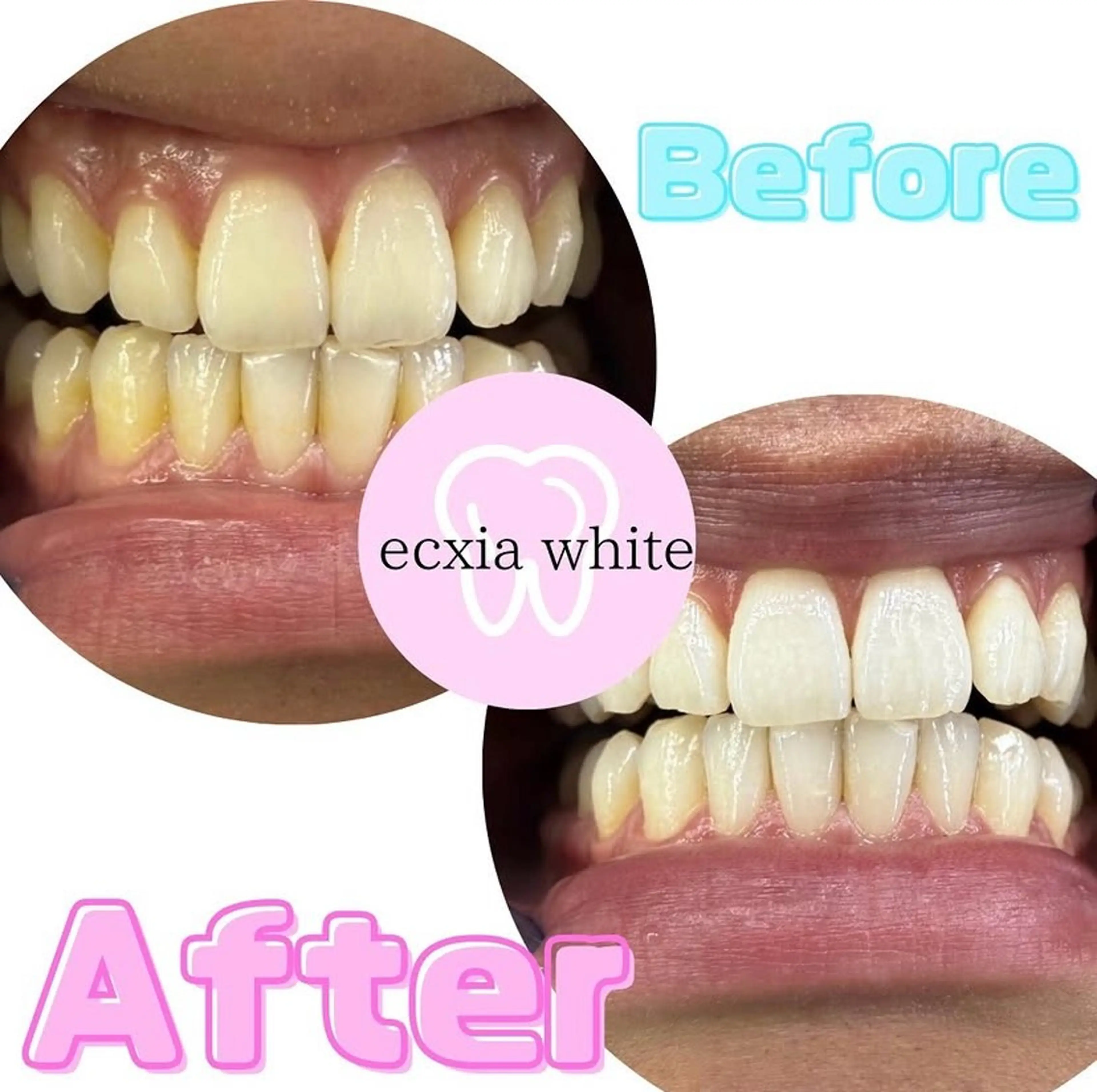 メンズ その他 nanami -ホワイトニングのその他イメージ