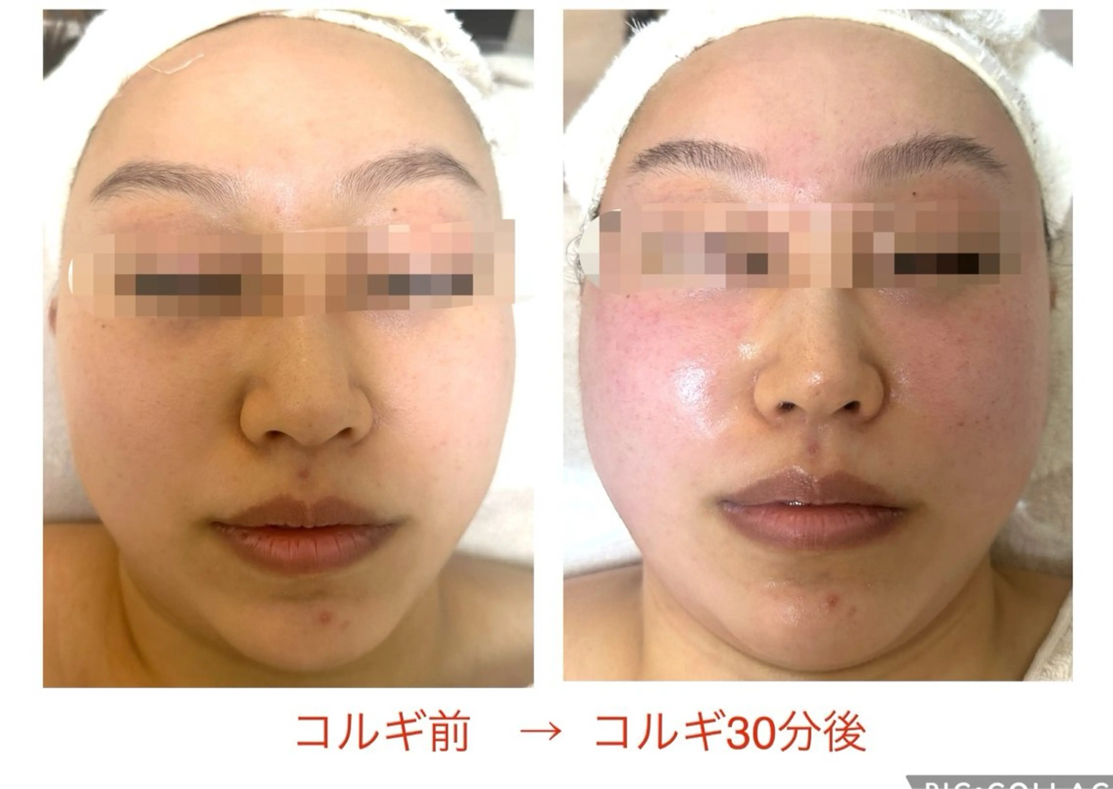 小顔コルギ10年 みなみ・池袋のエステ・リラクイメージ