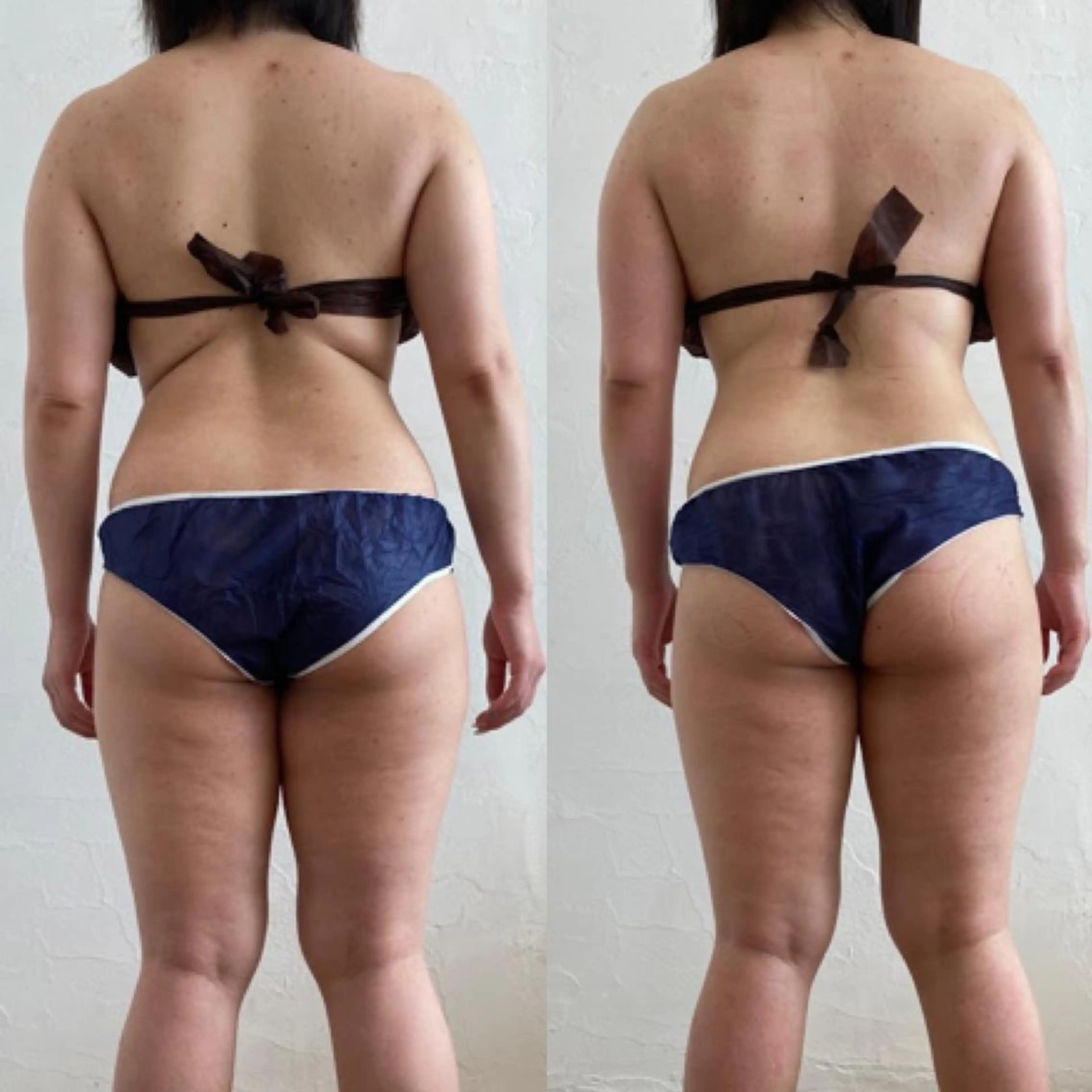 エステ リラク むくみ専門痩身 マクイエステティックのエステ・リラクイメージ