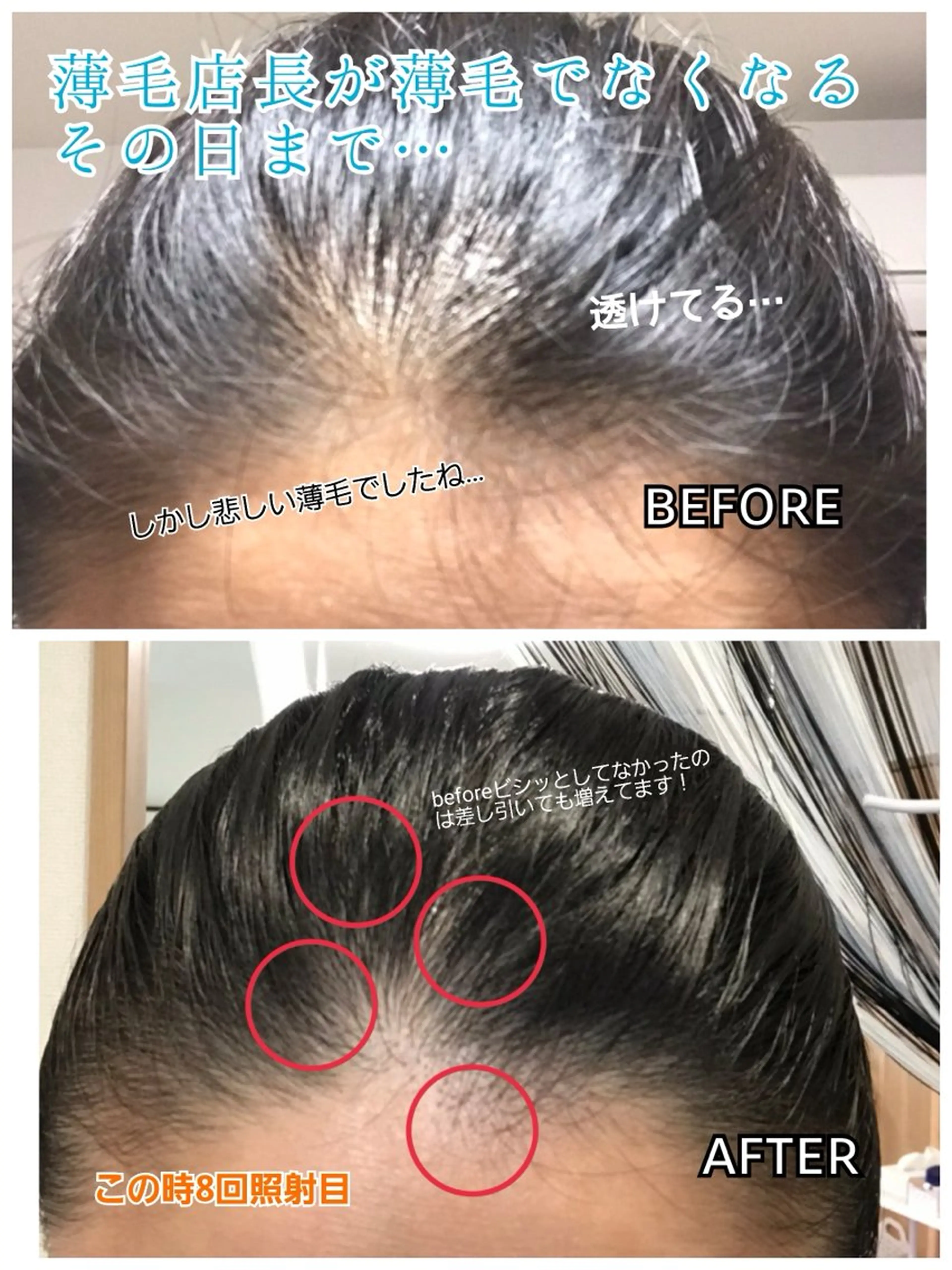 ヘッドスパ 五十嵐 蓮のその他イメージ