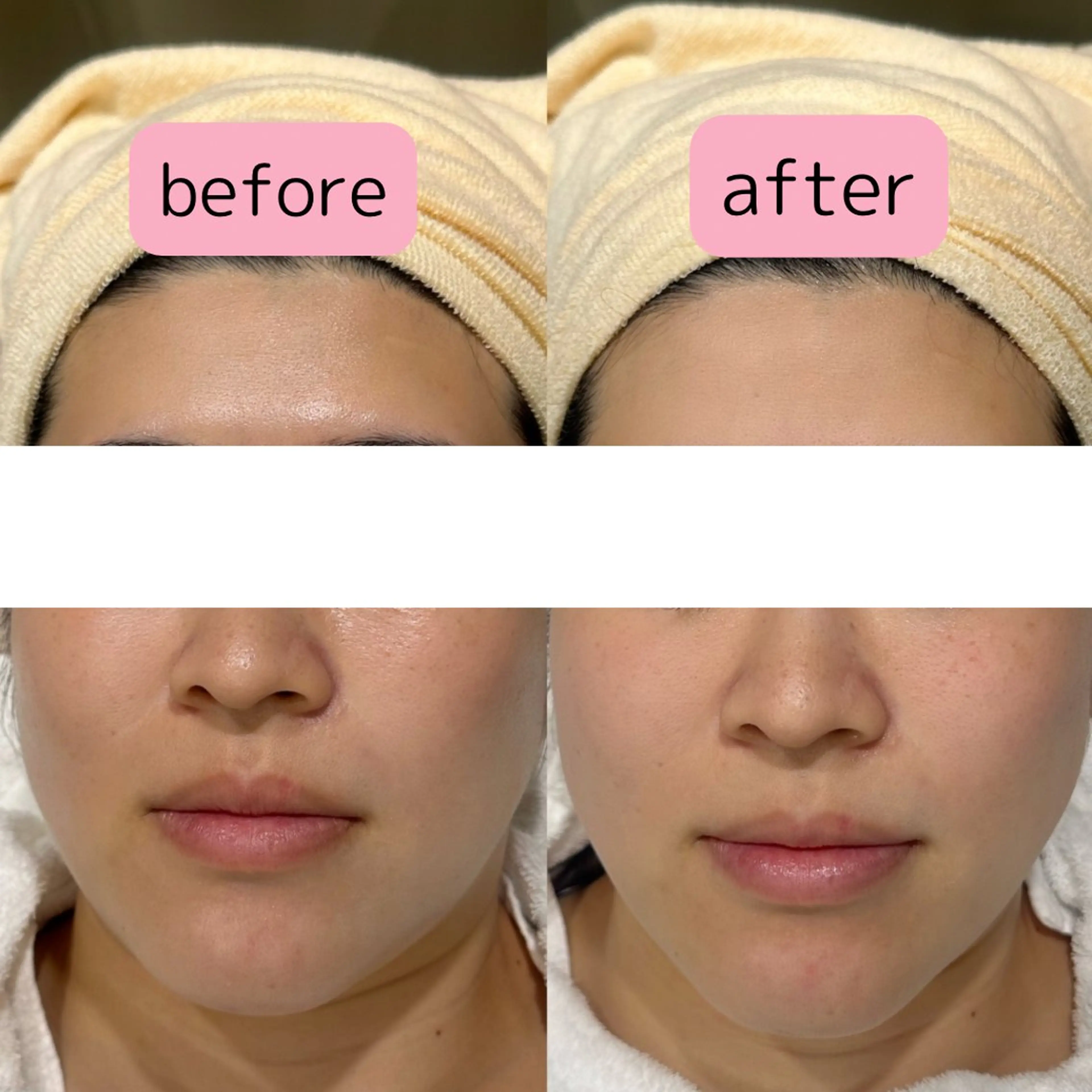 pansy フェイシャルエステのエステ・リラクイメージ