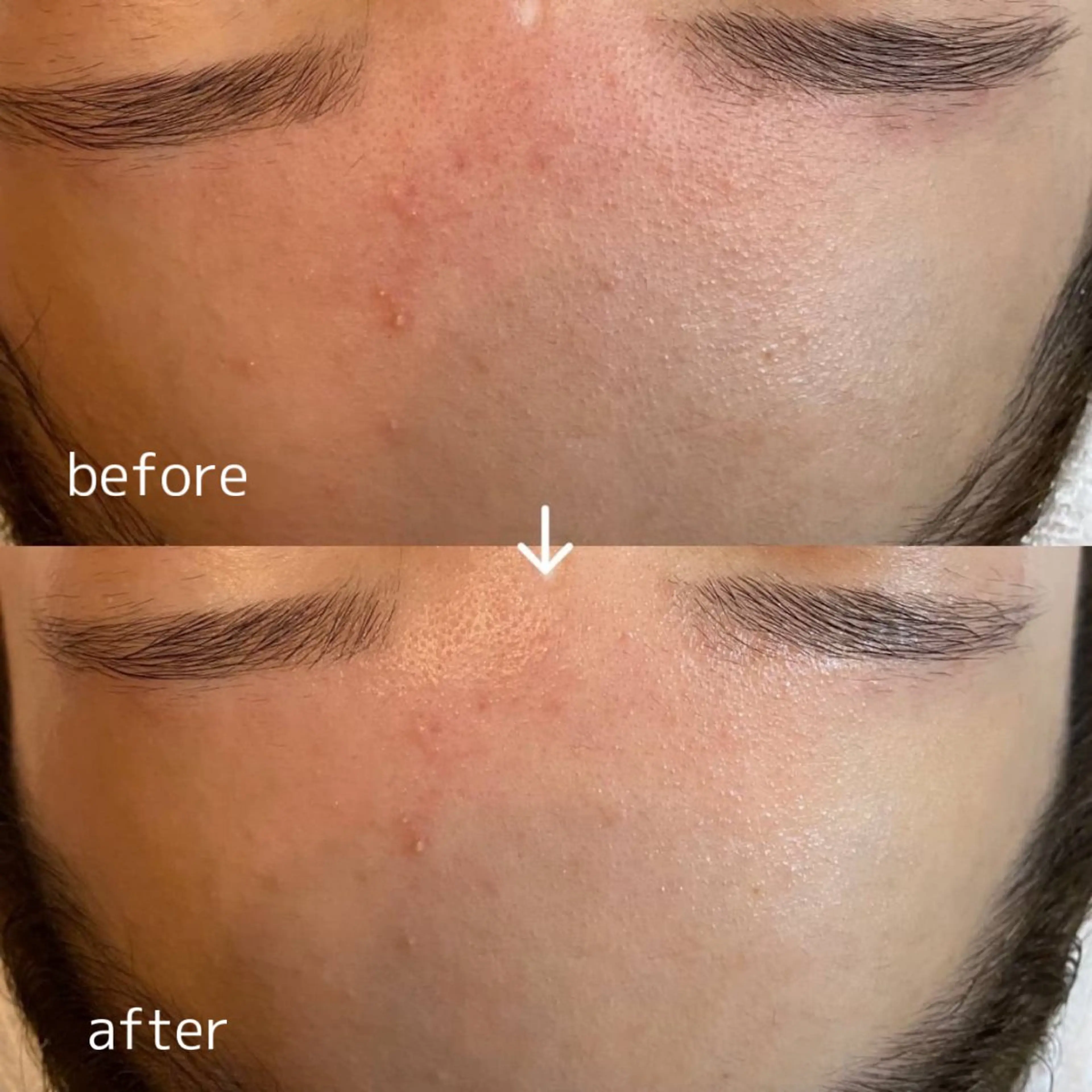 肌質改善サロン AMIのエステ・リラクイメージ